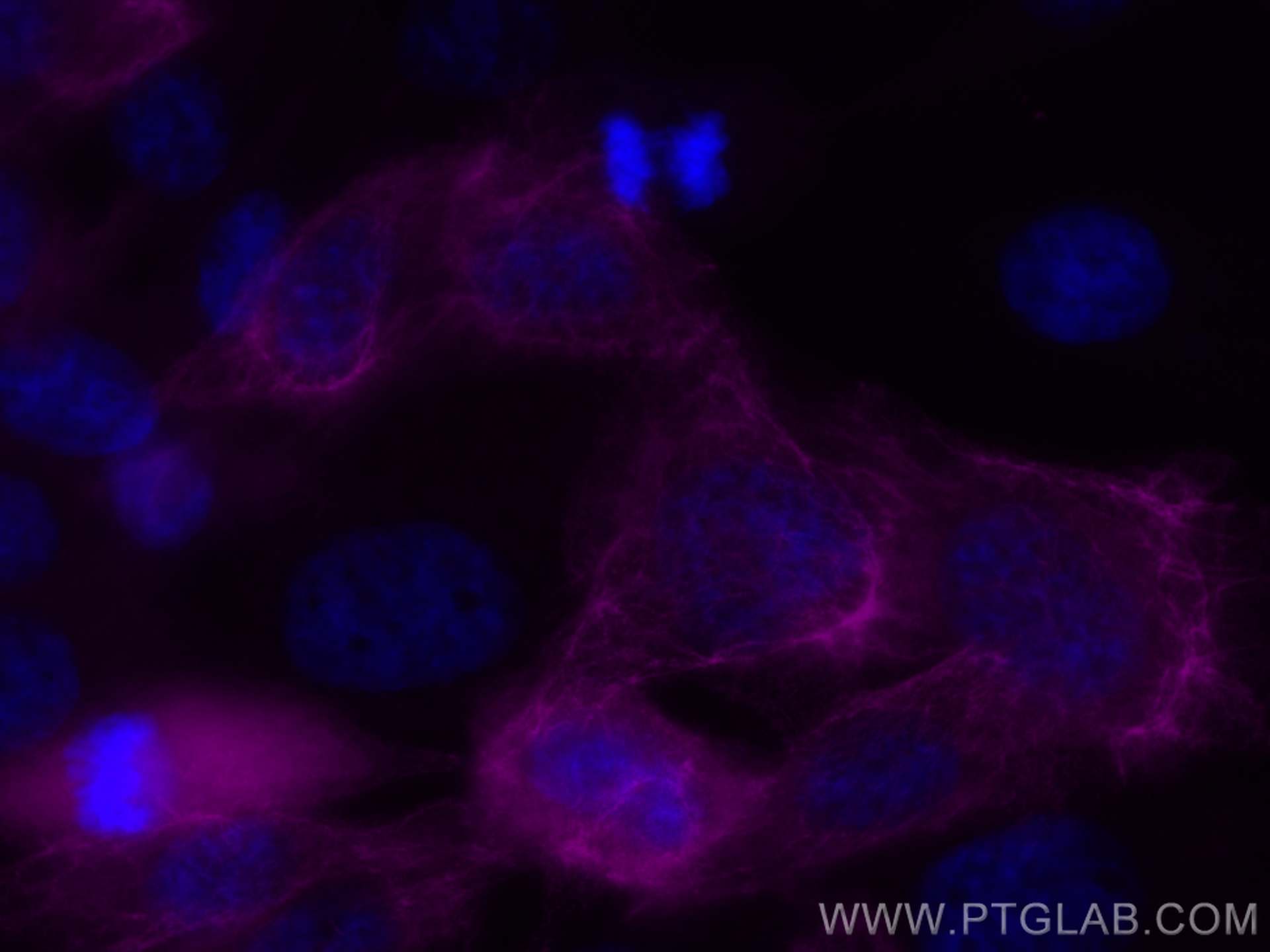 Immunofluorescence (IF) / fluorescent staining of A431 cells using CoraLite® Plus 647-conjugated Cytokeratin 6A Polyc (CL647-10590)