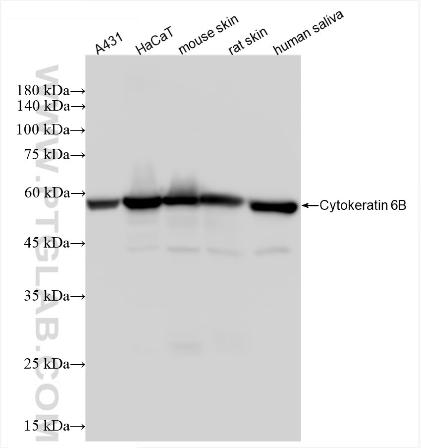 Western Blot (WB) analysis of various lysates using Cytokeratin 6B Recombinant antibody (85423-2-RR)