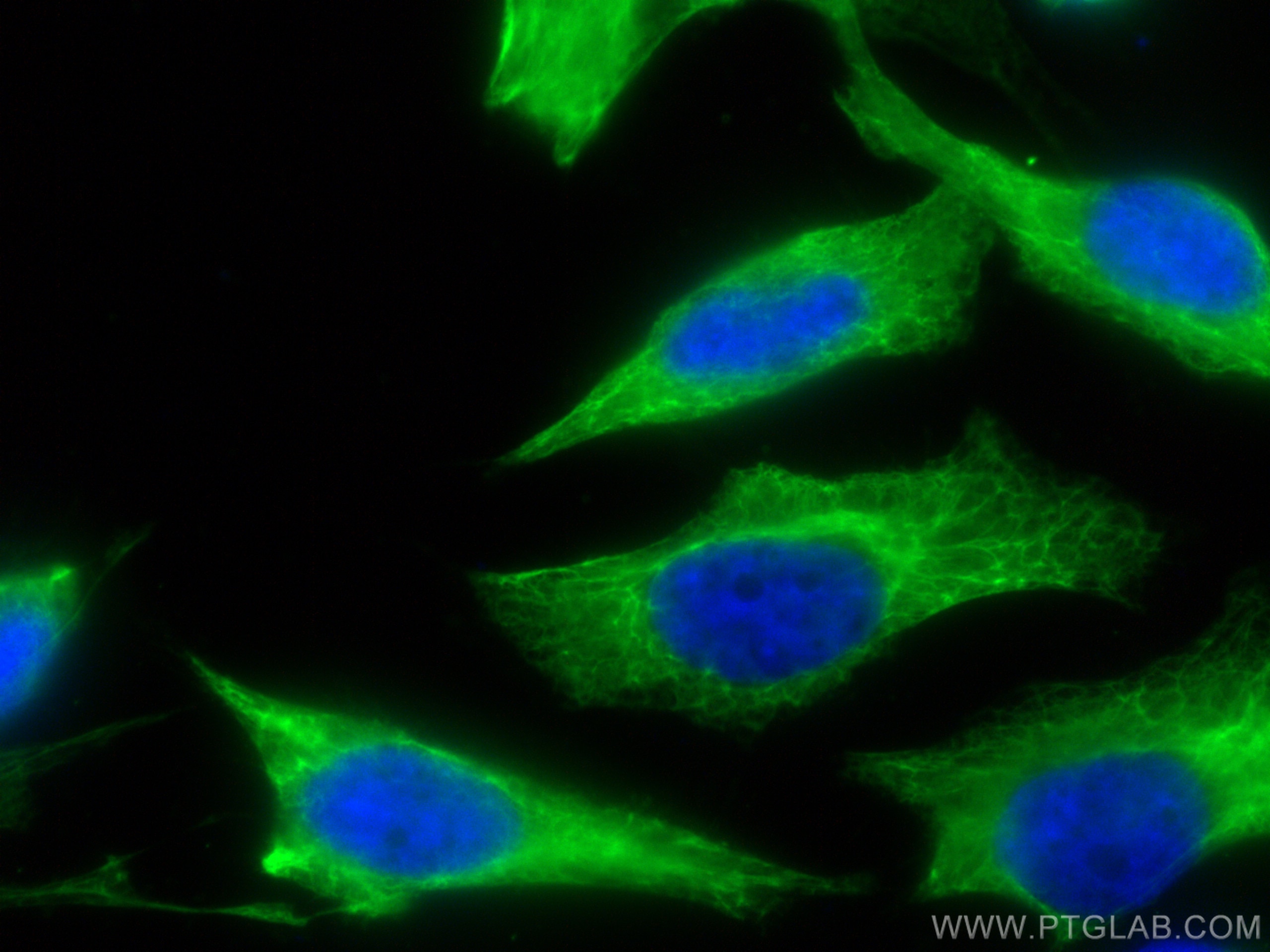 Immunofluorescence (IF) / fluorescent staining of HeLa cells using CoraLite® Plus 488-conjugated Cytokeratin 6B Polyc (CL488-17391)