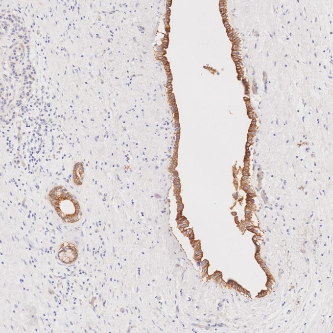 Immunohistochemistry (IHC) staining of human pancreas tissue using Cytokeratin 7 Monoclonal antibody (68296-1-Ig)