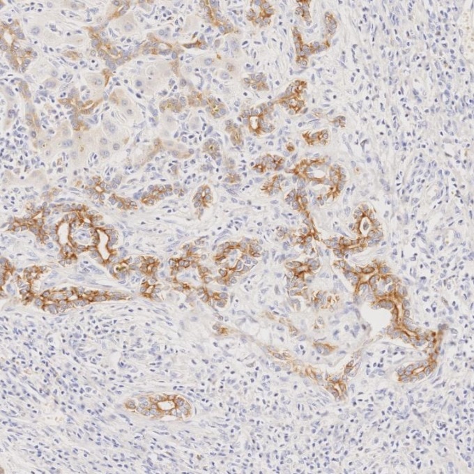 Immunohistochemistry (IHC) staining of human liver tissue using Cytokeratin 7 Monoclonal antibody (68296-1-Ig)
