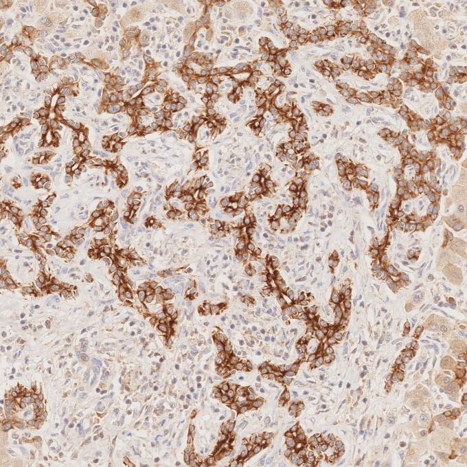 Immunohistochemistry (IHC) staining of human liver tissue using Cytokeratin 7 Monoclonal antibody (68296-1-Ig)