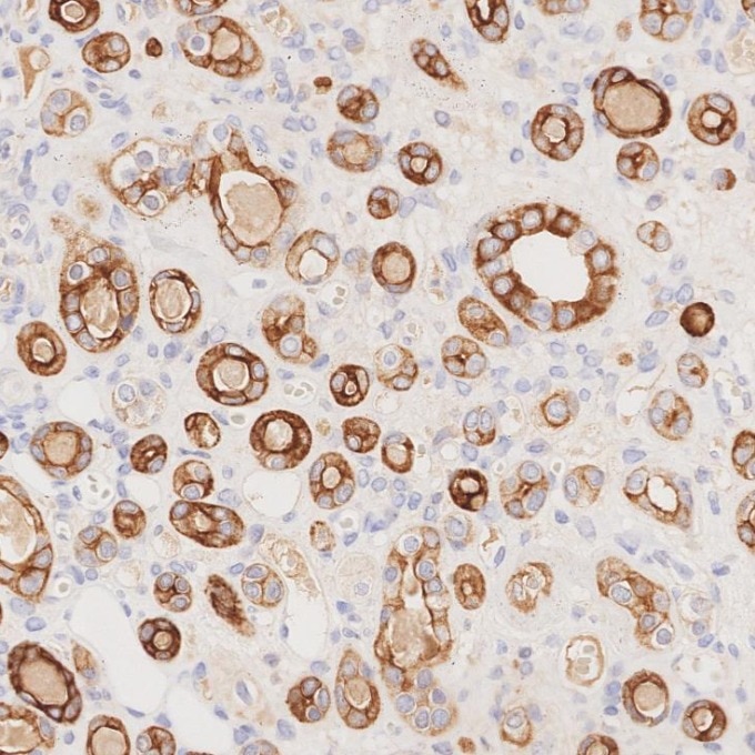 Immunohistochemistry (IHC) staining of human kidney tissue using Cytokeratin 7 Monoclonal antibody (68296-1-Ig)