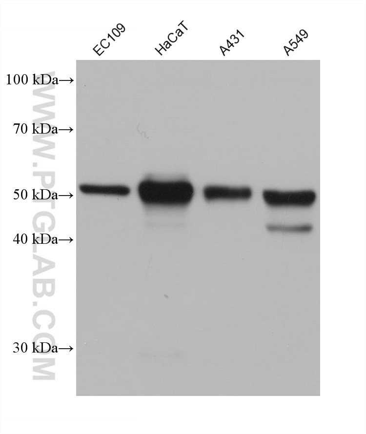 Western Blot (WB) analysis of various lysates using Cytokeratin 7 Monoclonal antibody (68296-1-Ig)