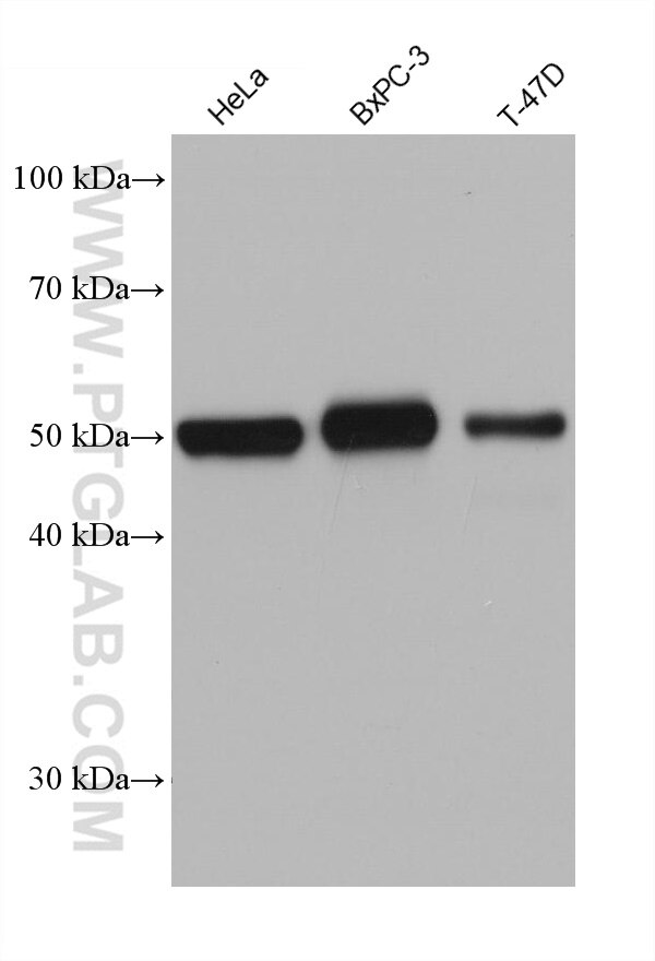 Western Blot (WB) analysis of various lysates using Cytokeratin 7 Monoclonal antibody (68296-1-Ig)