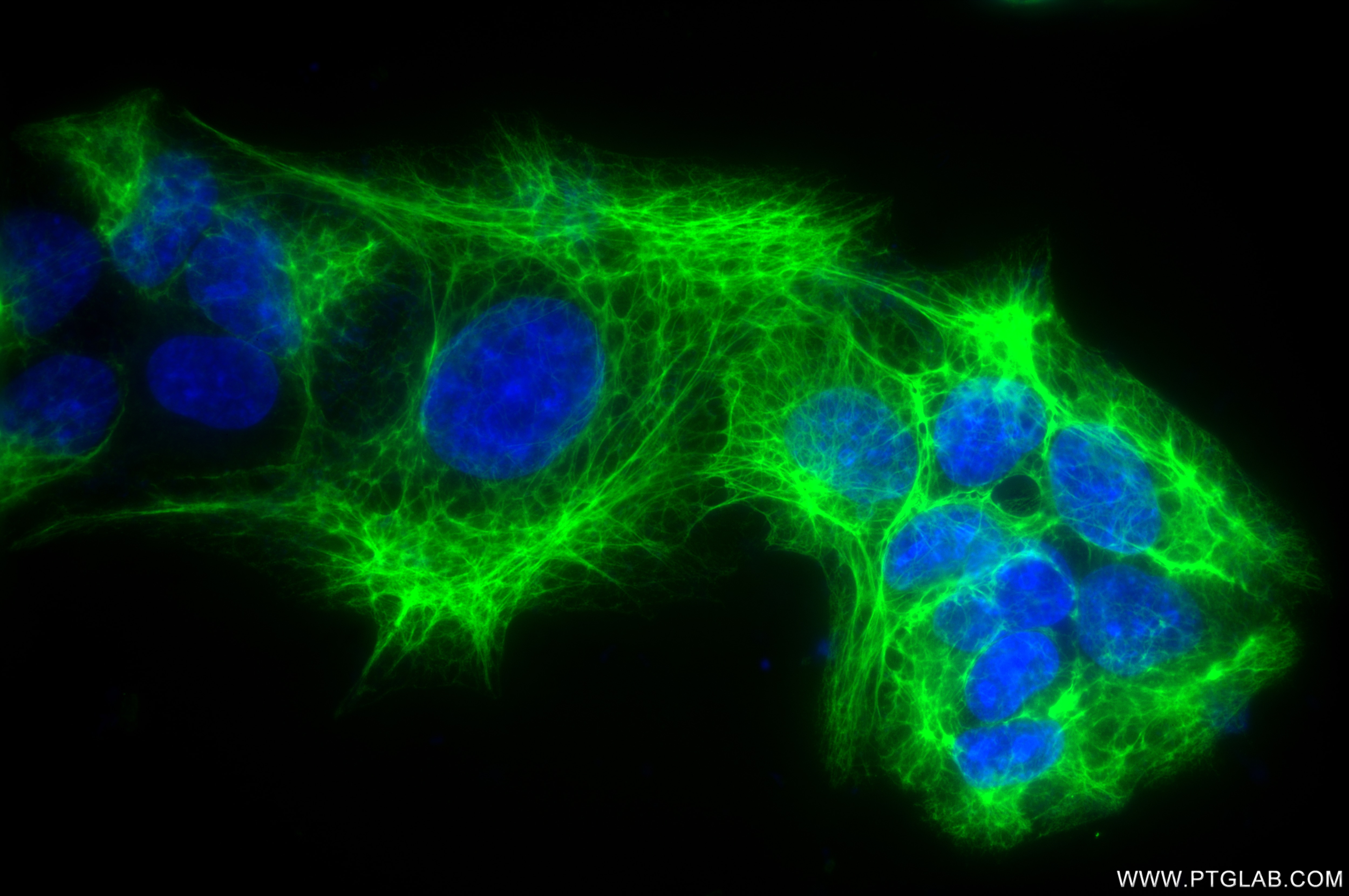 Immunofluorescence (IF) / fluorescent staining of HEPG2 cells using Cytokeratin 7 Recombinant antibody (86153-7-RR)
