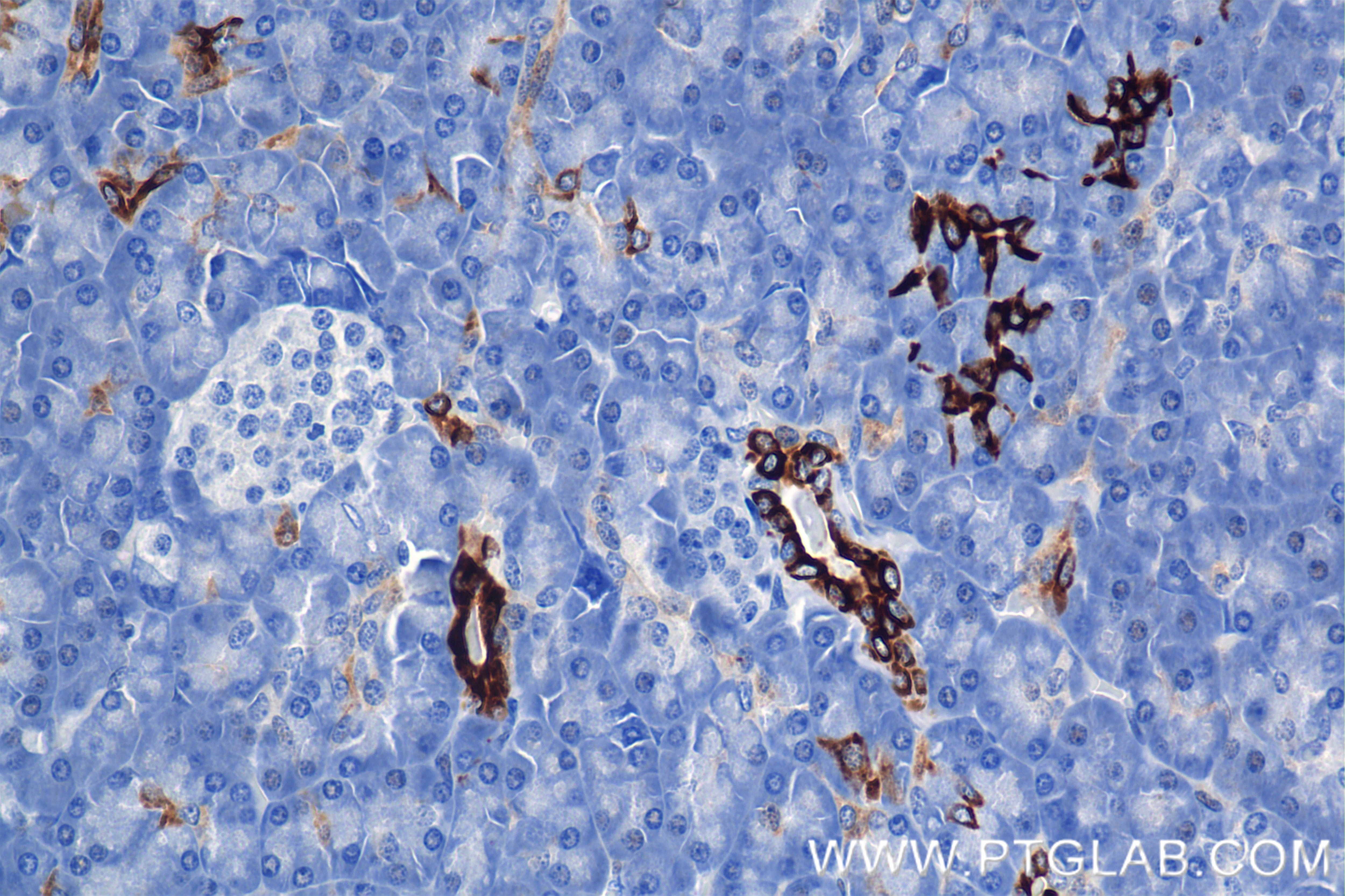 Immunohistochemistry (IHC) staining of human pancreas tissue using Cytokeratin 7 Recombinant antibody (86153-7-RR)