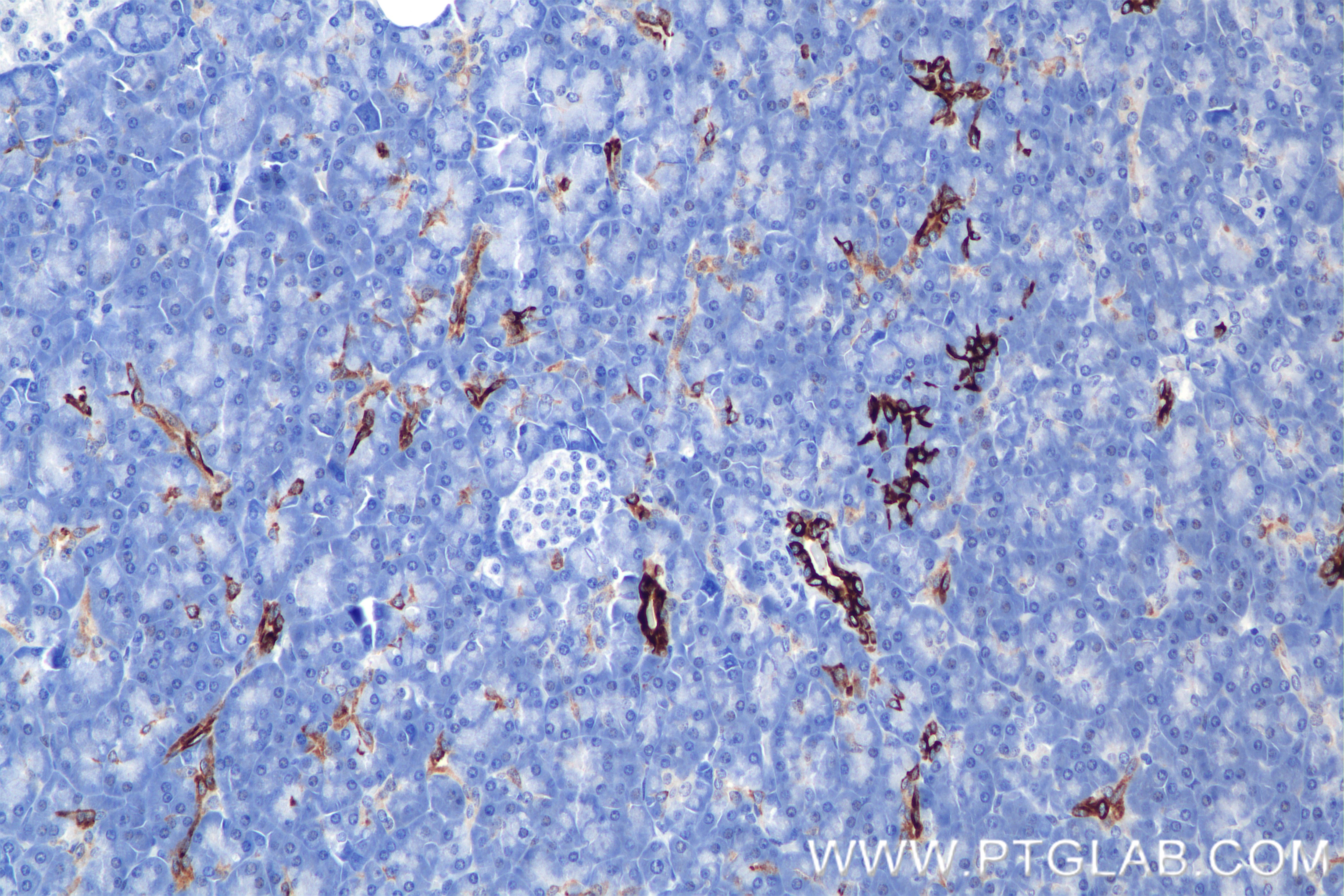 Immunohistochemistry (IHC) staining of human pancreas tissue using Cytokeratin 7 Recombinant antibody (86153-7-RR)