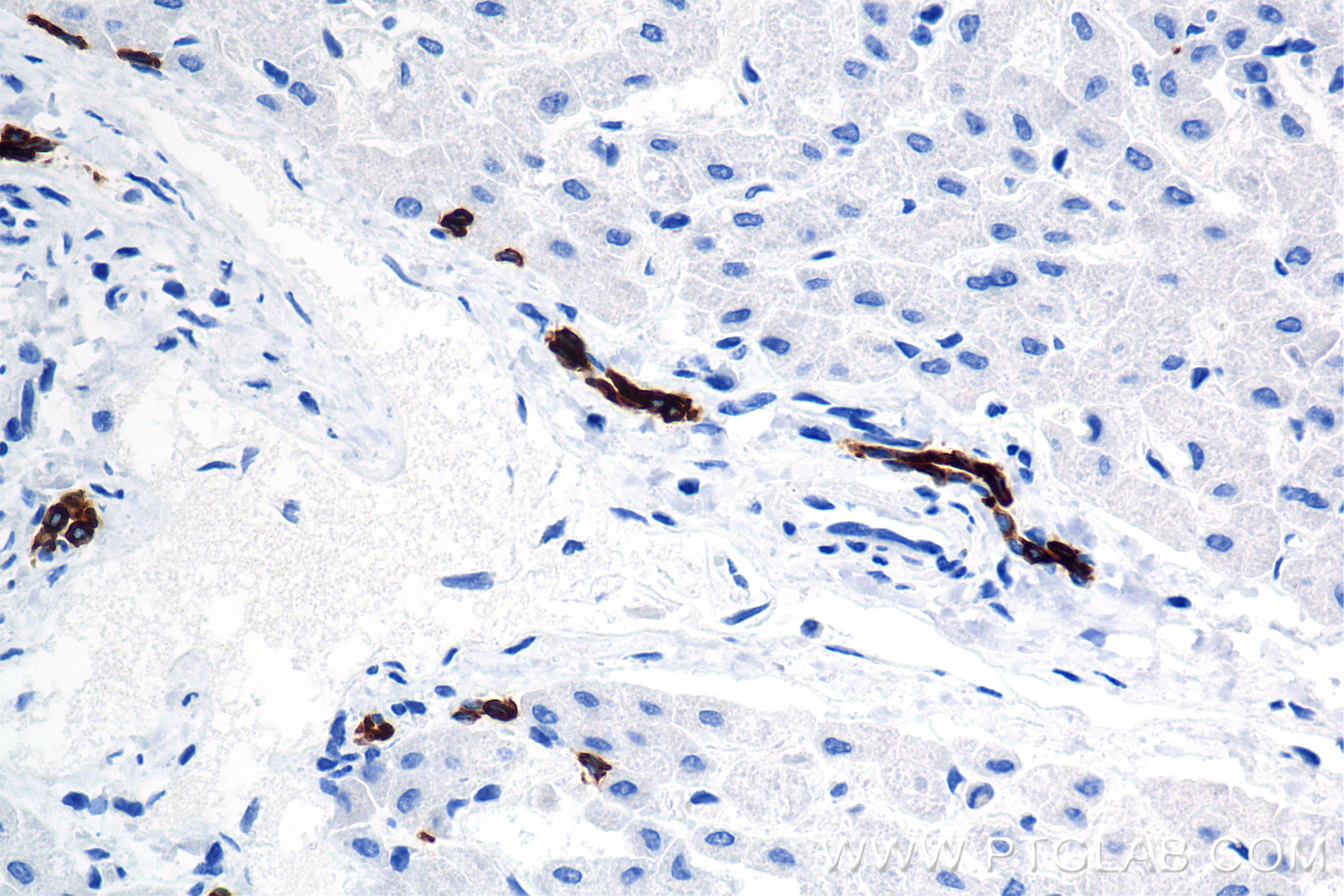 Immunohistochemistry (IHC) staining of human liver tissue using Cytokeratin 7 Recombinant antibody (86153-7-RR)