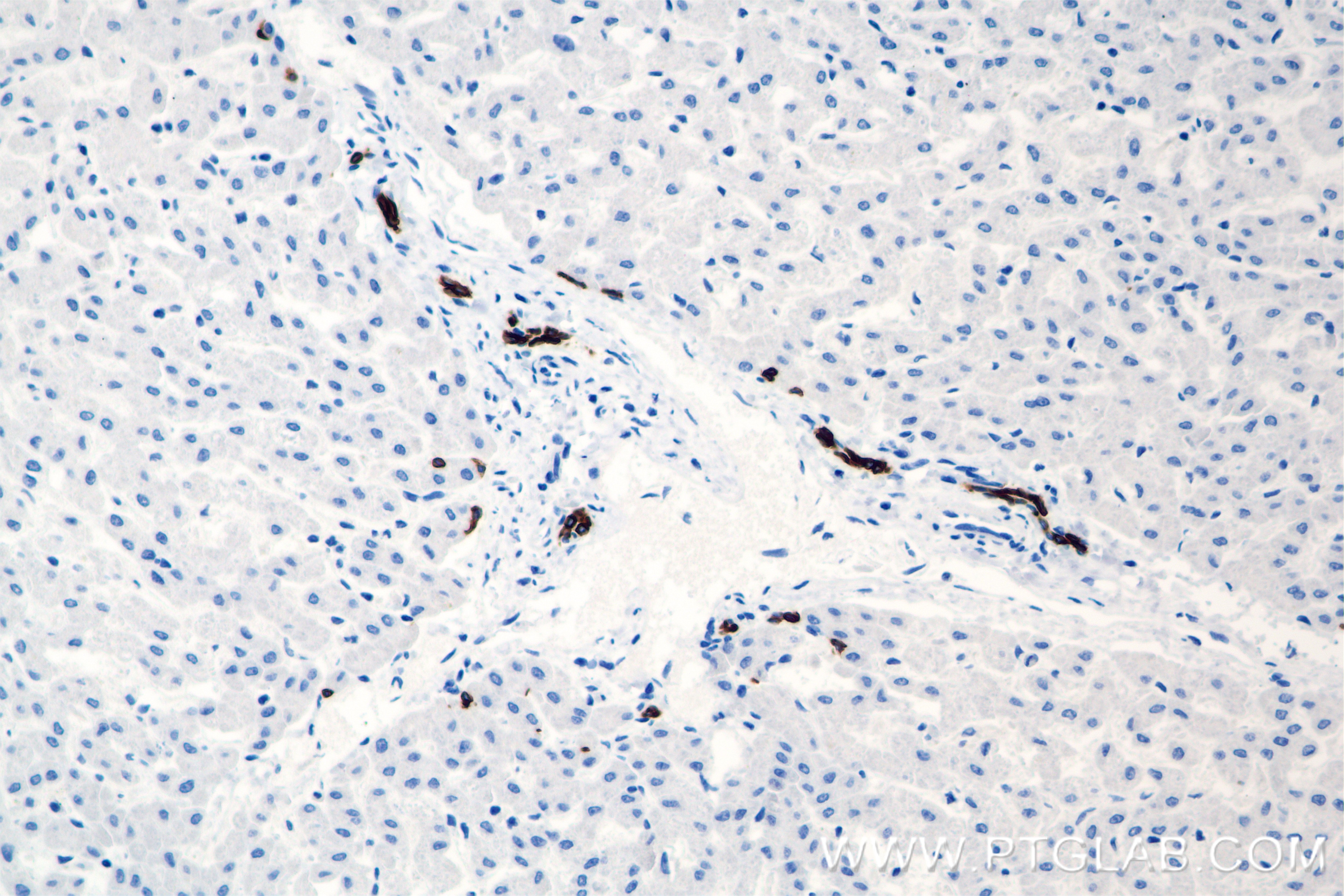 Immunohistochemistry (IHC) staining of human liver tissue using Cytokeratin 7 Recombinant antibody (86153-7-RR)