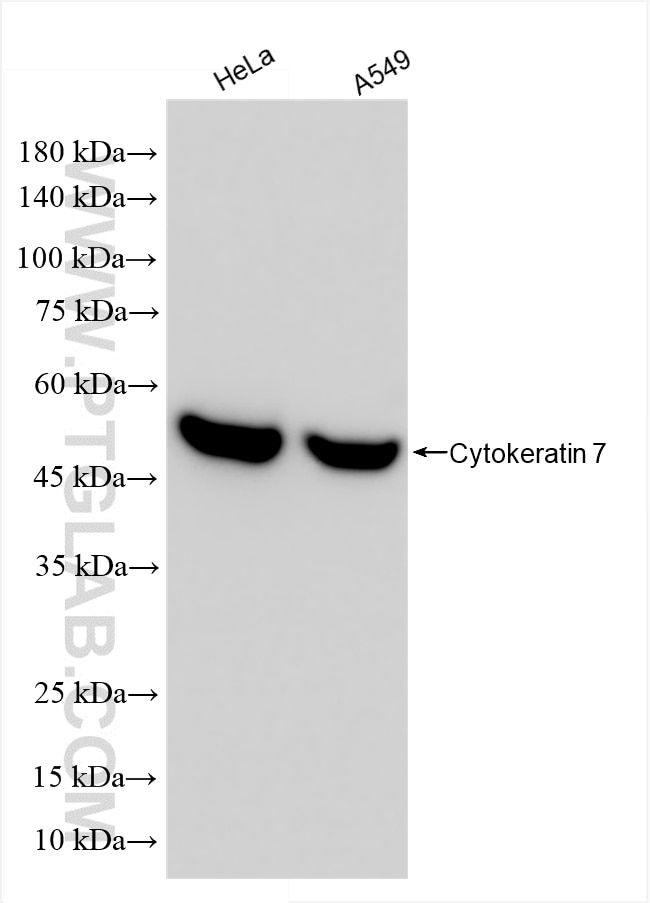 Western Blot (WB) analysis of various lysates using Cytokeratin 7 Recombinant antibody (86153-7-RR)