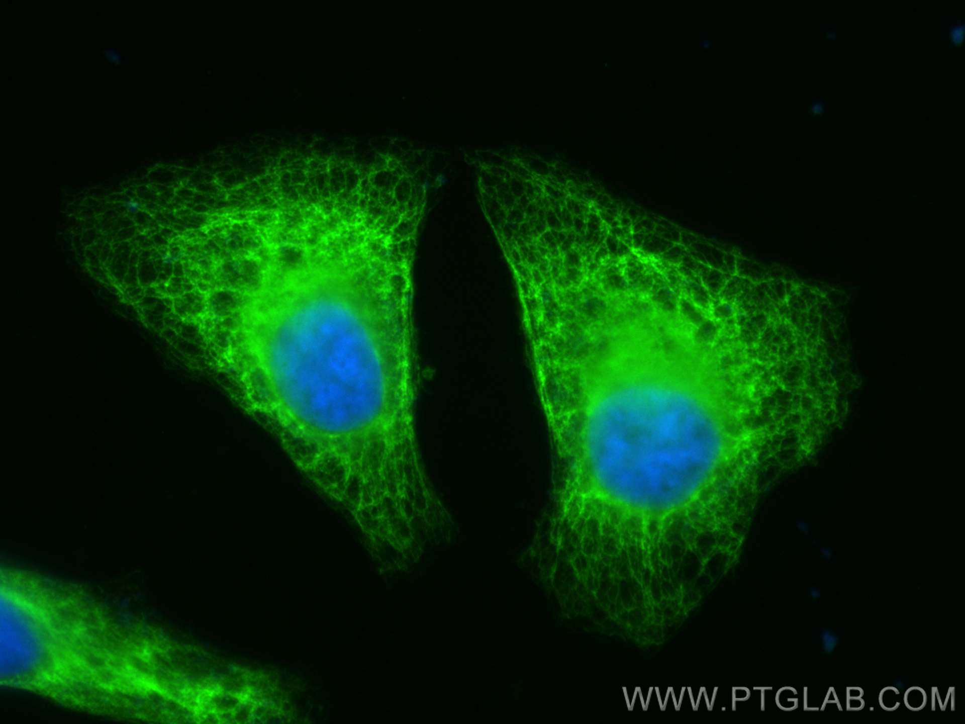 Immunofluorescence (IF) / fluorescent staining of HeLa cells using CoraLite® Plus 488-conjugated human Cytokeratin 7  (CL488-15539)