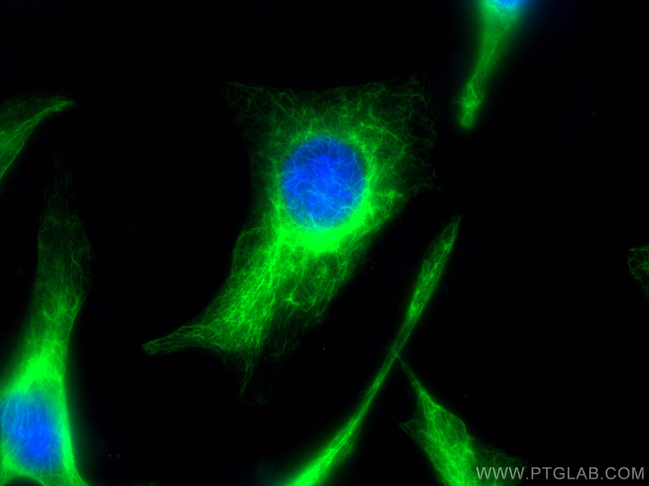 Immunofluorescence (IF) / fluorescent staining of HeLa cells using CoraLite® Plus 488-conjugated Cytokeratin 7 Polycl (CL488-22208)