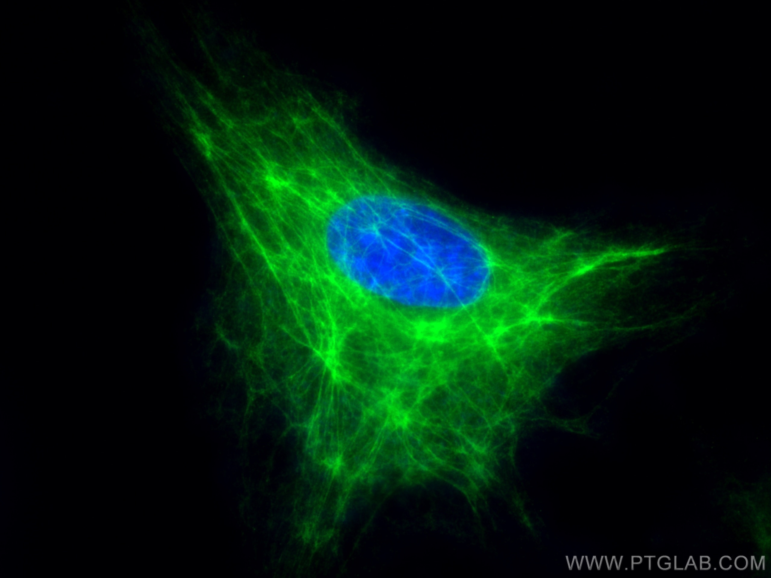 Immunofluorescence (IF) / fluorescent staining of HeLa cells using CoraLite® Plus 488-conjugated Cytokeratin 7 Polycl (CL488-22208)