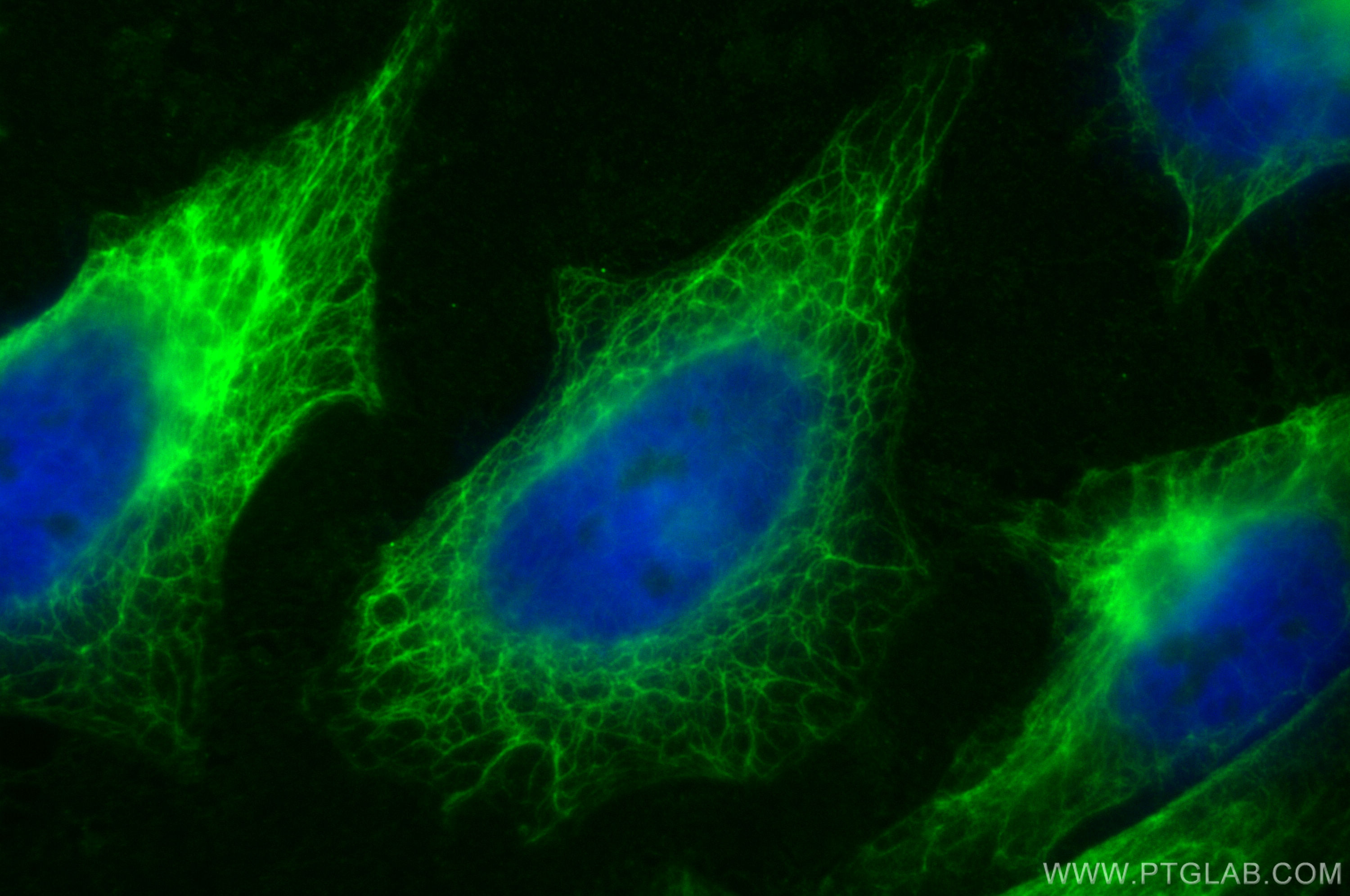 Immunofluorescence (IF) / fluorescent staining of HeLa cells using CoraLite® Plus 488-conjugated Cytokeratin 7 Polycl (CL488-22208)