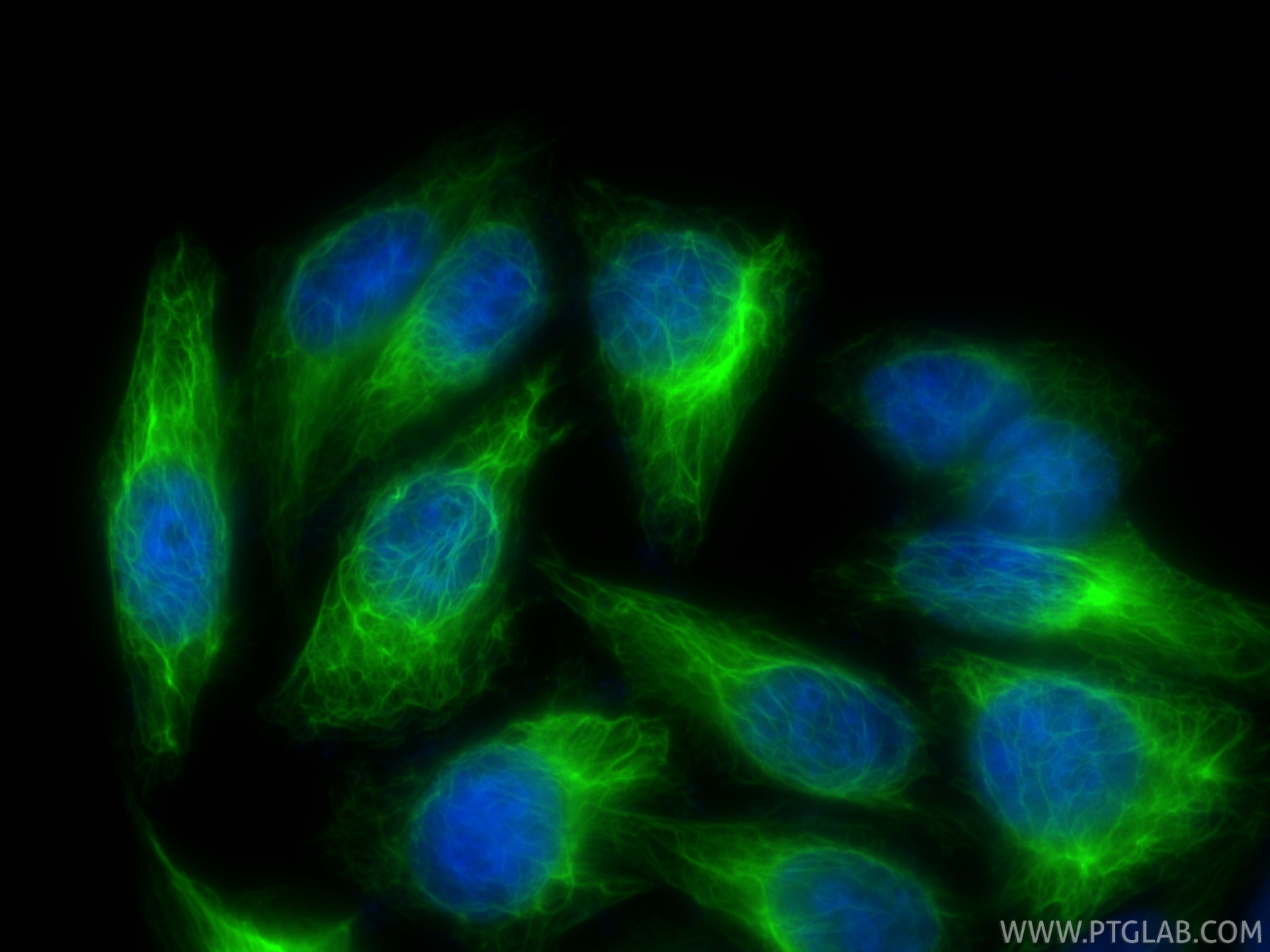 Immunofluorescence (IF) / fluorescent staining of HepG2 cells using CoraLite® Plus 488-conjugated Cytokeratin 7 Recomb (CL488-86153-7)