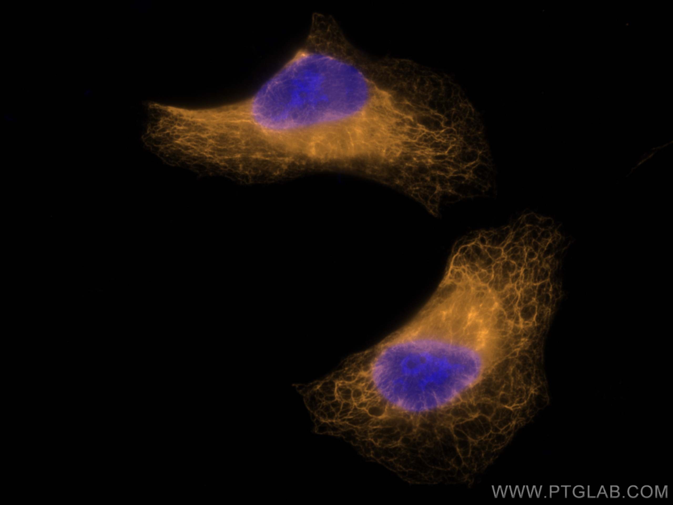 Immunofluorescence (IF) / fluorescent staining of HeLa cells using CoraLite®555-conjugated Cytokeratin 7 Polyclonal a (CL555-15539)