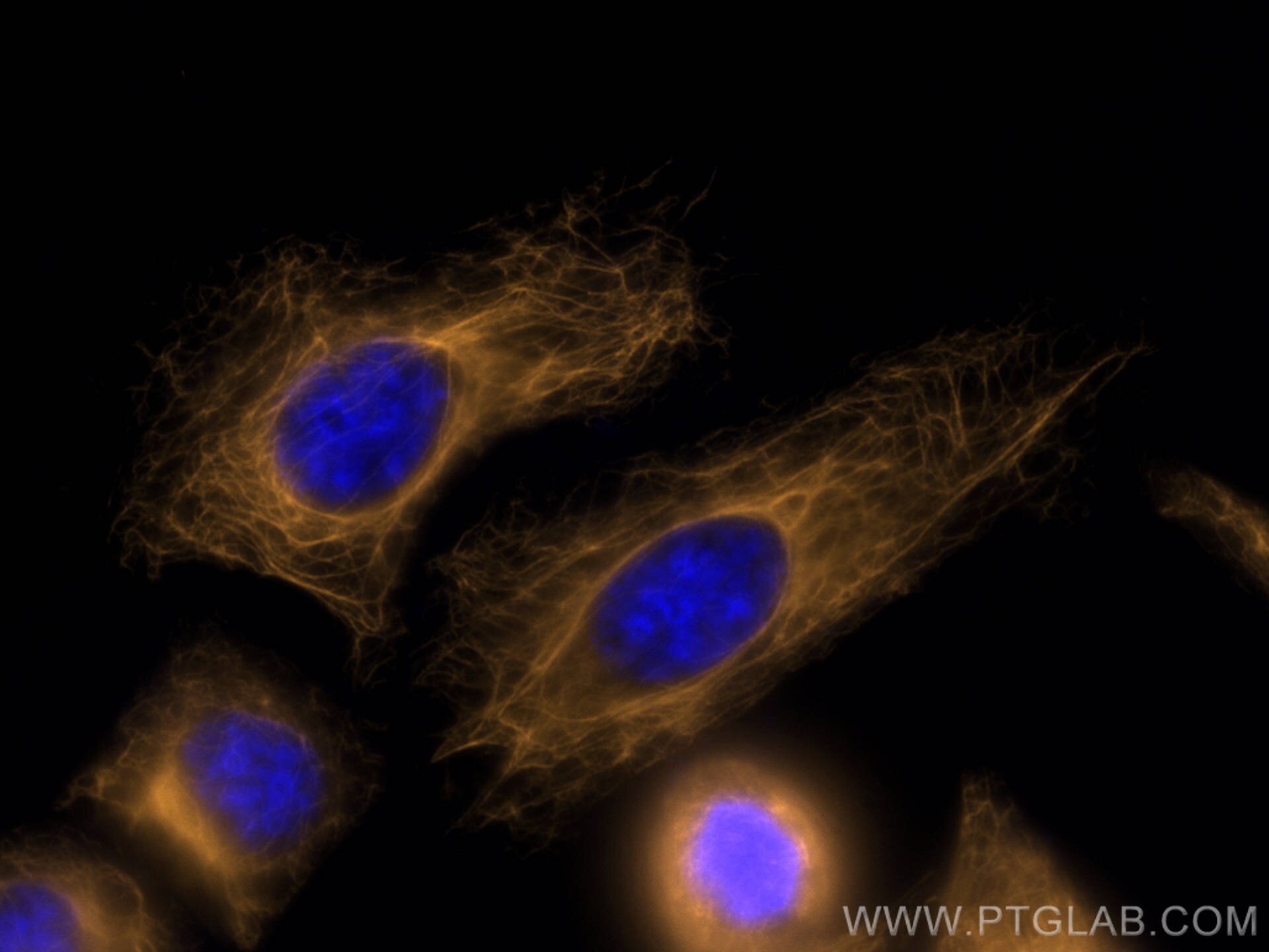 Immunofluorescence (IF) / fluorescent staining of HepG2 cells using CoraLite®555-conjugated Cytokeratin 7 Polyclonal a (CL555-15539)