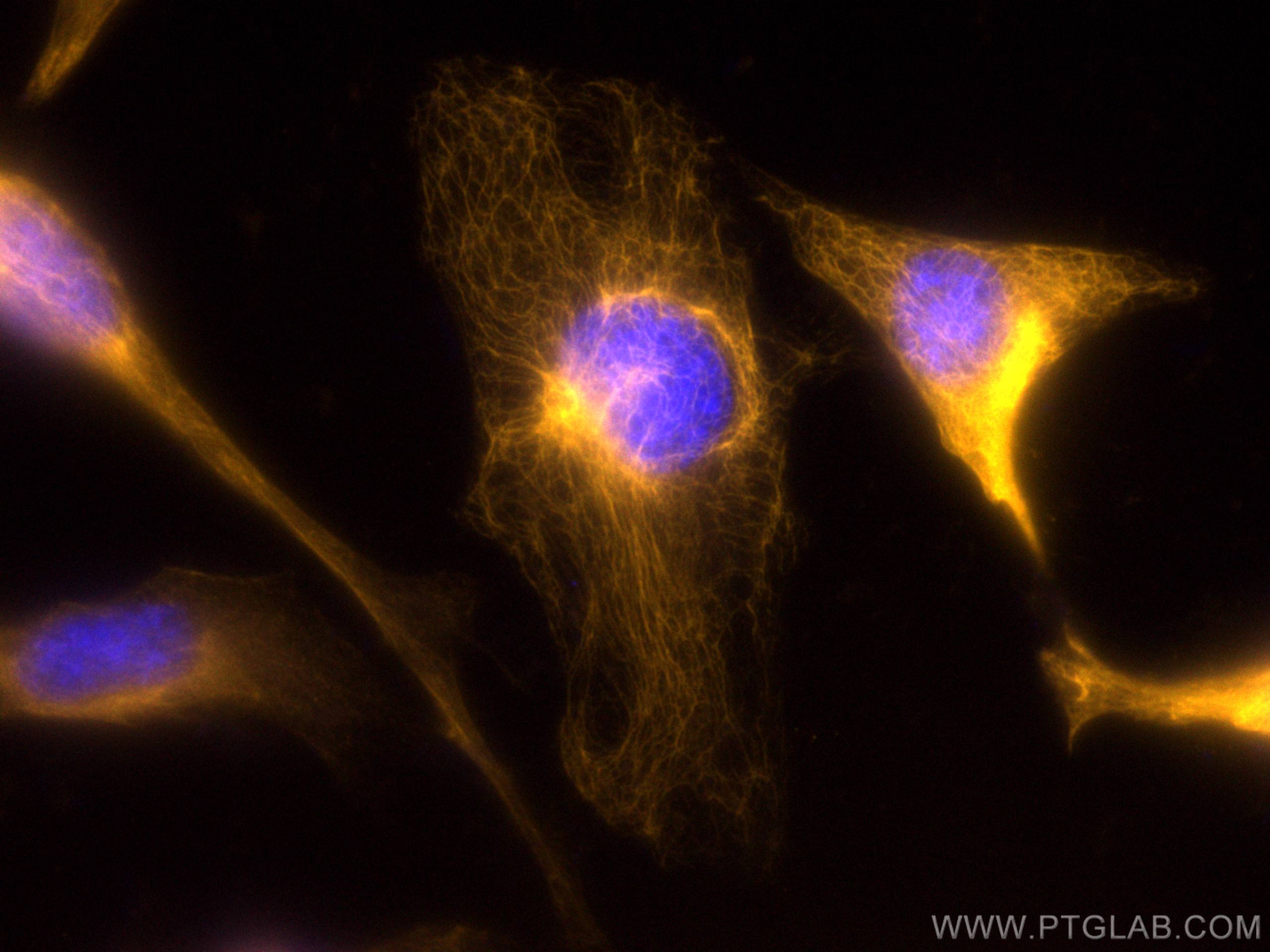 Immunofluorescence (IF) / fluorescent staining of HeLa cells using CoraLite®555-conjugated Cytokeratin 7 Polyclonal a (CL555-22208)