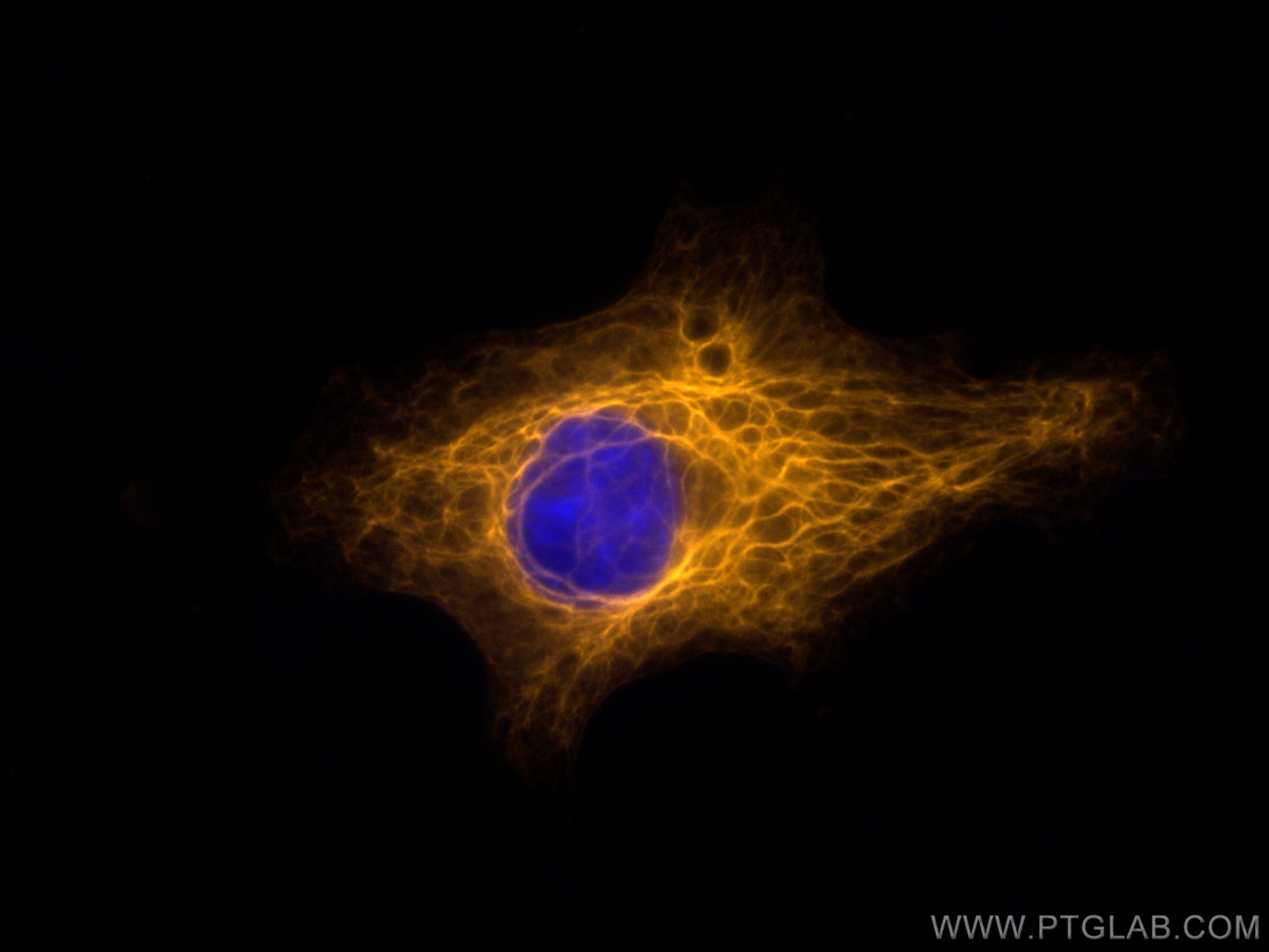 Immunofluorescence (IF) / fluorescent staining of HeLa cells using CoraLite®555-conjugated Cytokeratin 7 Polyclonal a (CL555-22208)