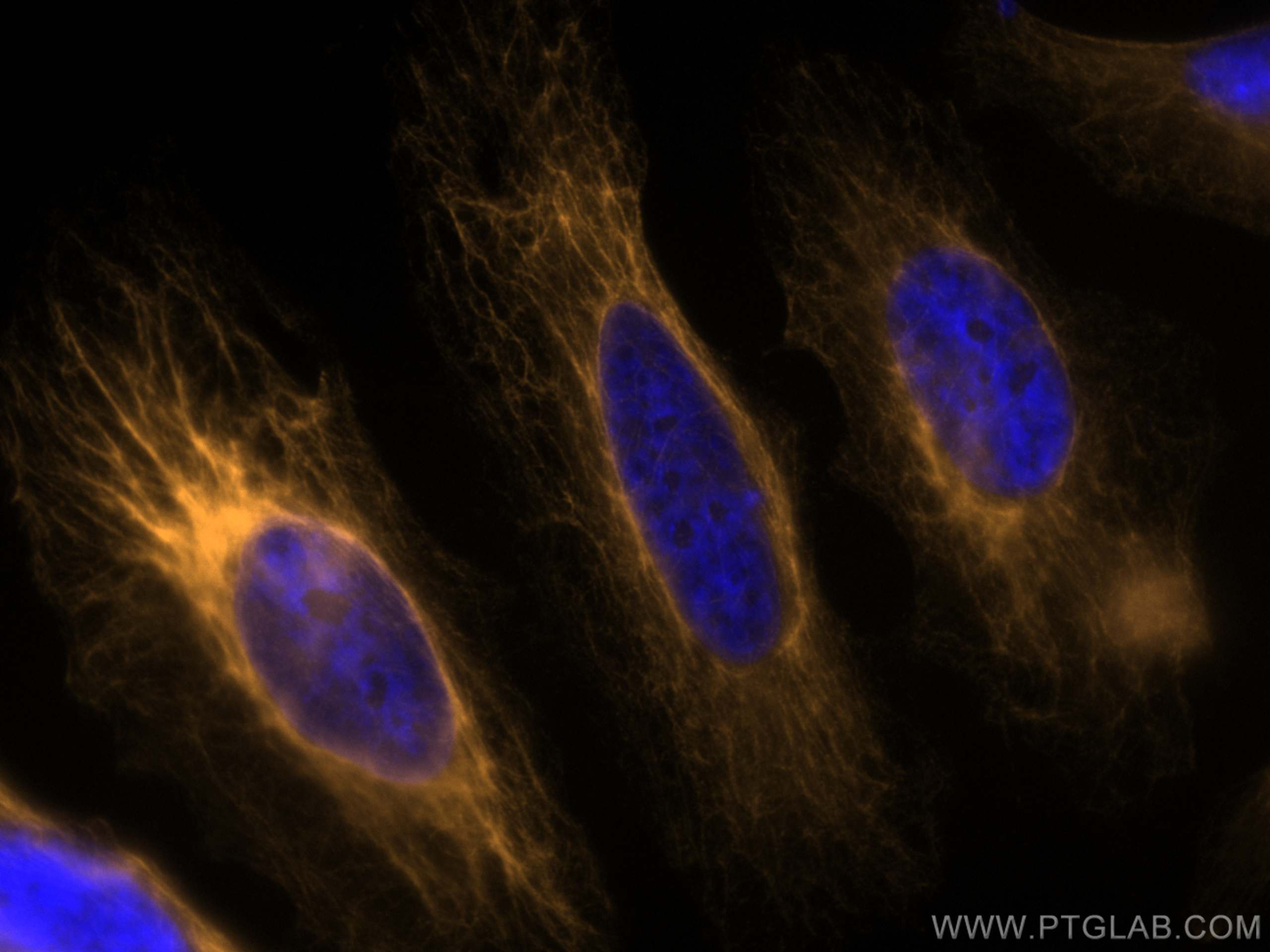 Immunofluorescence (IF) / fluorescent staining of HeLa cells using CoraLite®555-conjugated Cytokeratin 7 Polyclonal a (CL555-22208)
