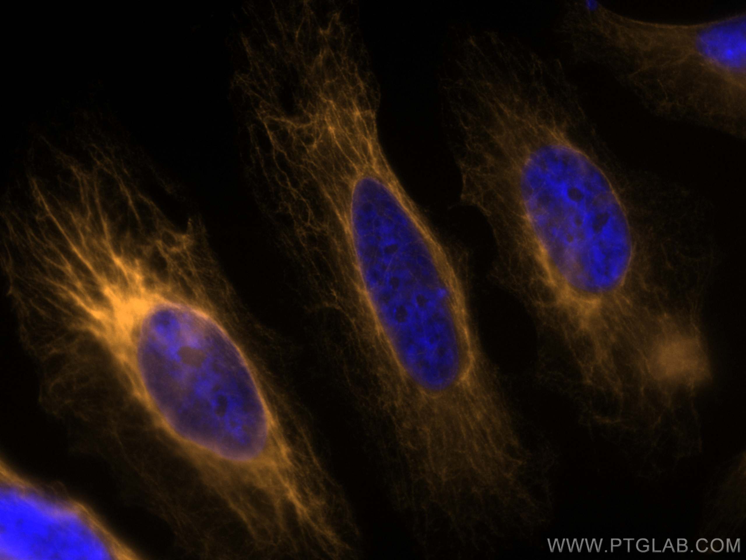 IF Staining of HeLa using CL555-22208