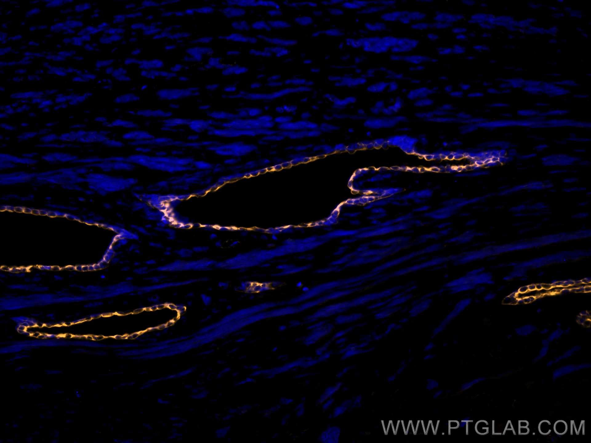 IF Staining of human prostate cancer using CL555-66483