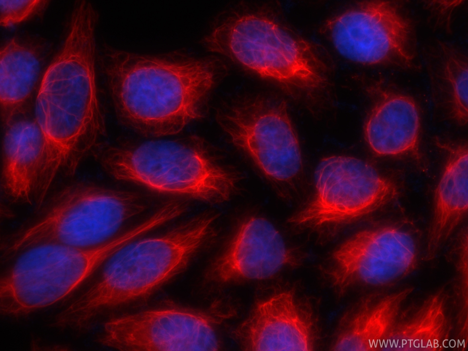 Immunofluorescence (IF) / fluorescent staining of HepG2 cells using CoraLite®594-conjugated Cytokeratin 7 Recombinant  (CL594-86153-7)