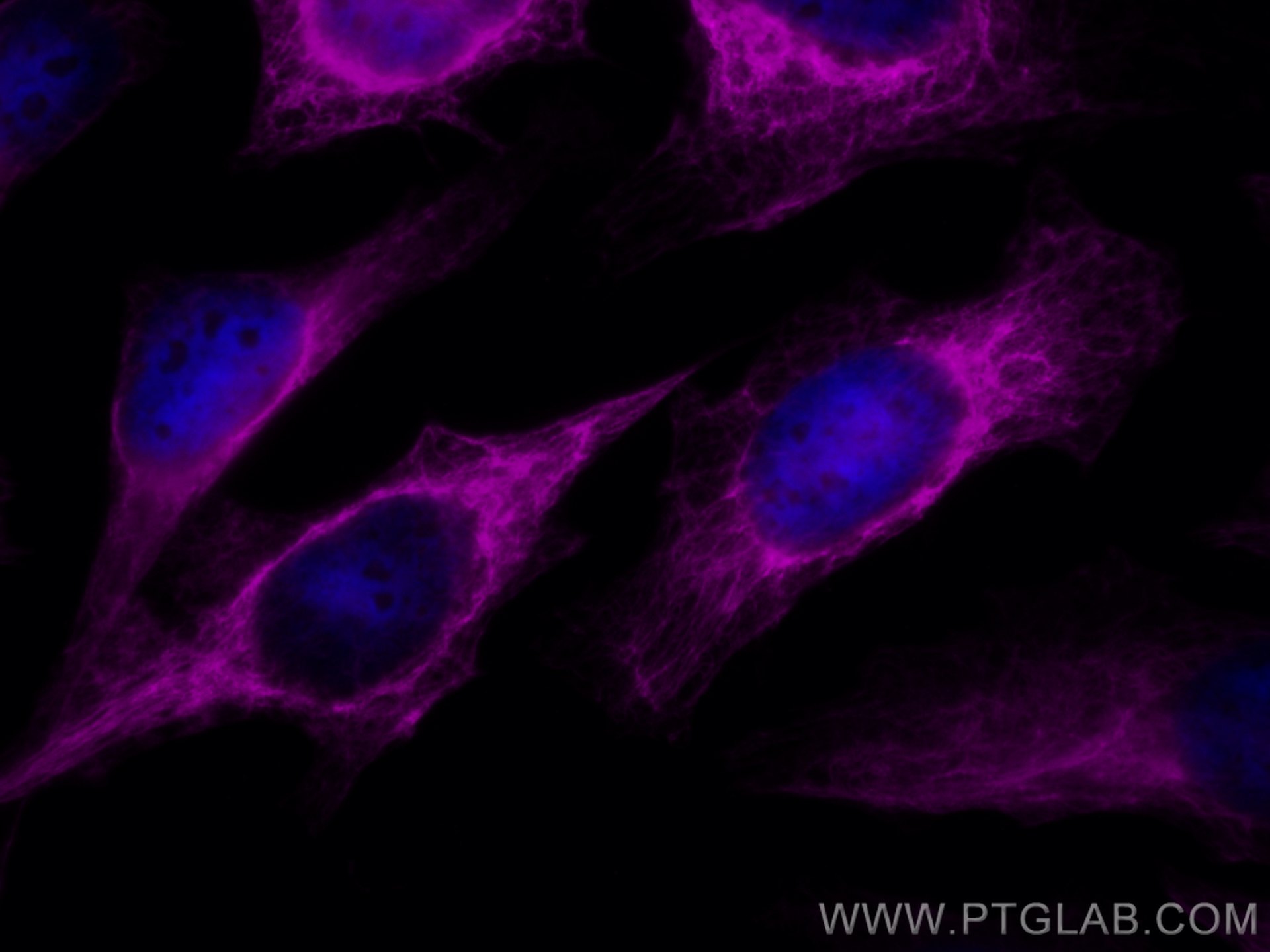 Immunofluorescence (IF) / fluorescent staining of HeLa cells using CoraLite® Plus 647-conjugated Cytokeratin 7 Polycl (CL647-22208)