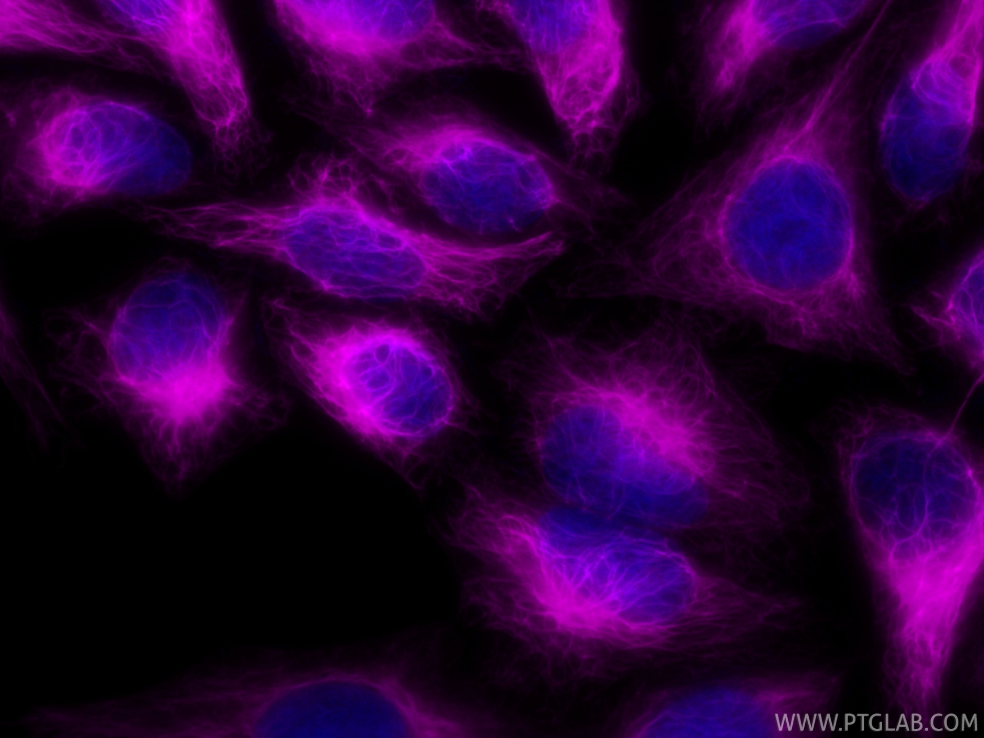Immunofluorescence (IF) / fluorescent staining of HepG2 cells using CoraLite® Plus 647-conjugated Cytokeratin 7 Recomb (CL647-86153-7)