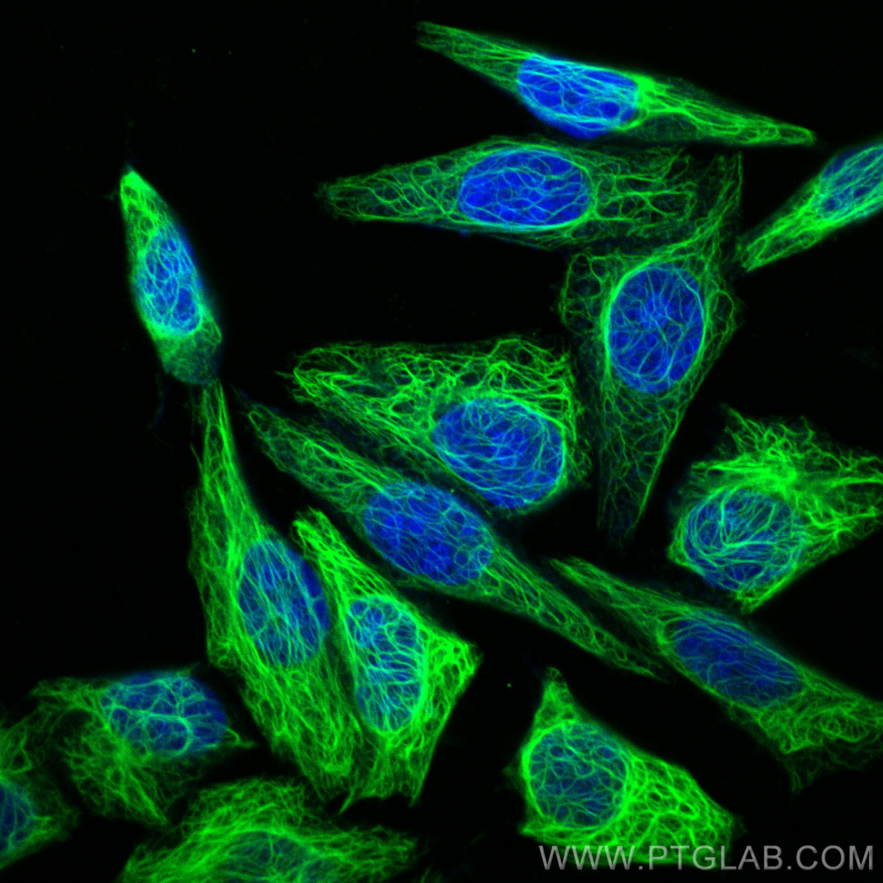 Immunofluorescence (IF) / fluorescent staining of HepG2 cells using CoraLite® Plus 488-conjugated Cytokeratin 7-specif (CL488-17513)