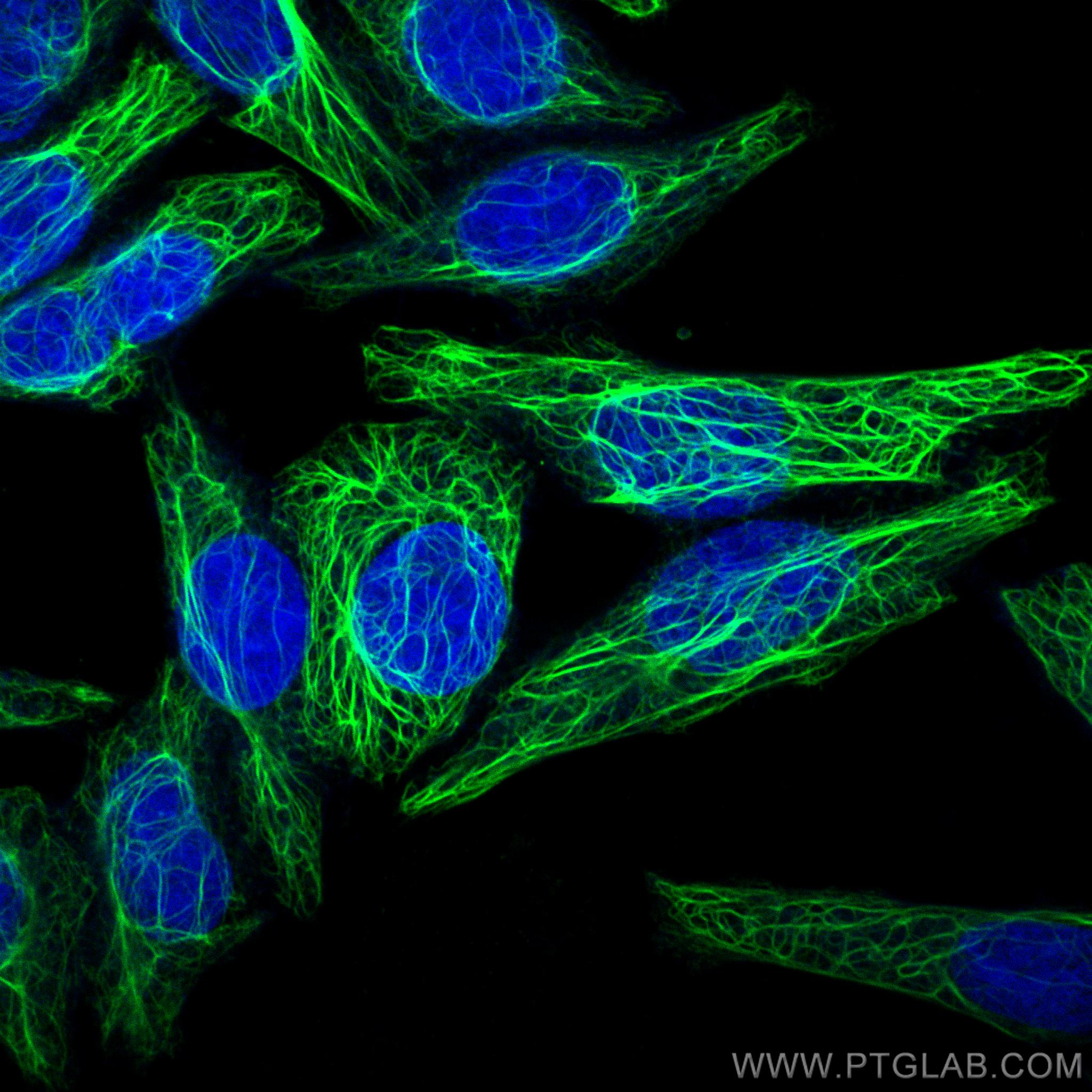 Immunofluorescence (IF) / fluorescent staining of HepG2 cells using CoraLite® Plus 488-conjugated Cytokeratin 7-specif (CL488-17513)