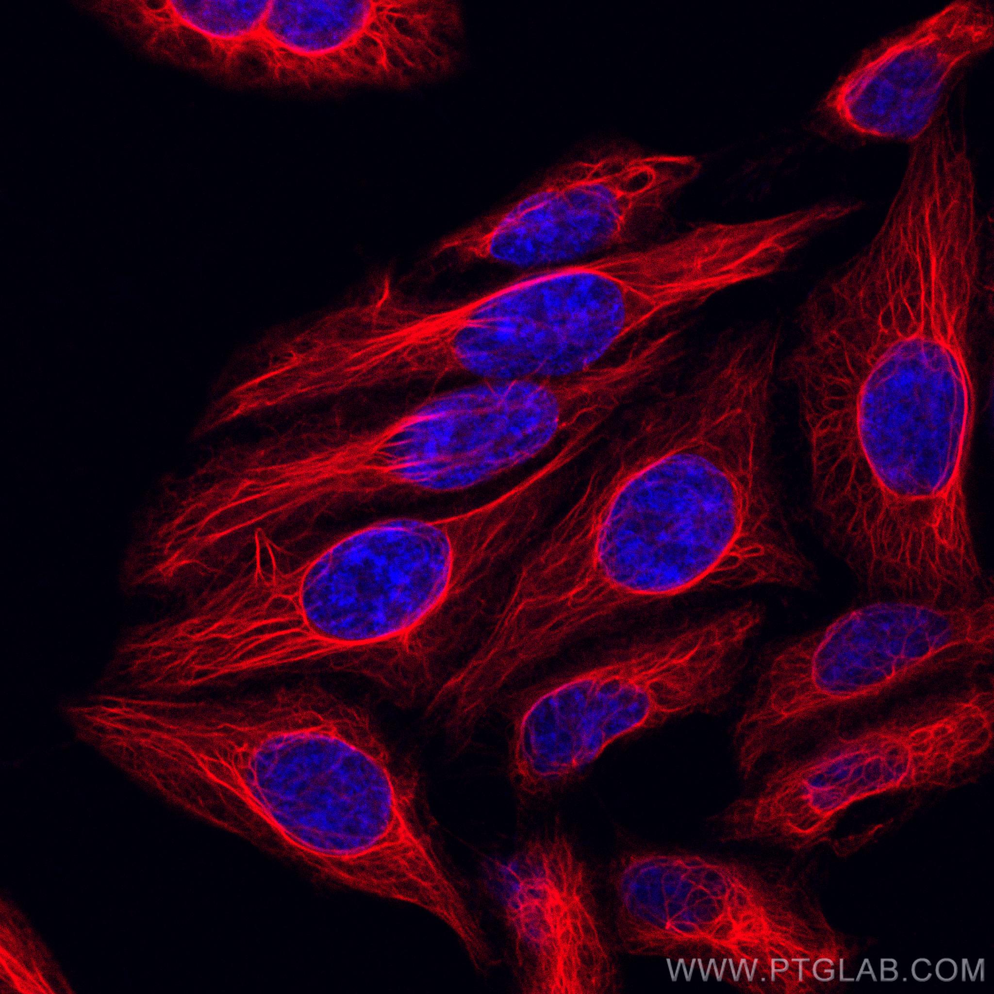 Immunofluorescence (IF) / fluorescent staining of HepG2 cells using CoraLite®594-conjugated Cytokeratin 7-specific Pol (CL594-17513)