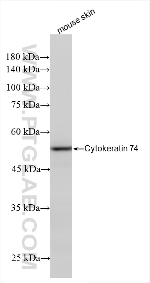 Western Blot (WB) analysis of mouse skin tissue using Cytokeratin 74 Recombinant antibody (86325-2-RR)