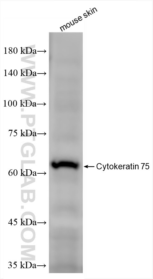 Western Blot (WB) analysis of mouse skin tissue using Cytokeratin 75 Recombinant antibody (86382-1-RR)