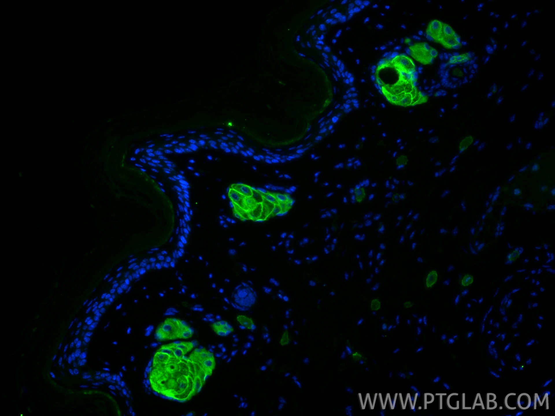 Immunofluorescence (IF) / fluorescent staining of mouse skin tissue using Cytokeratin 79 Recombinant antibody (86310-1-RR)