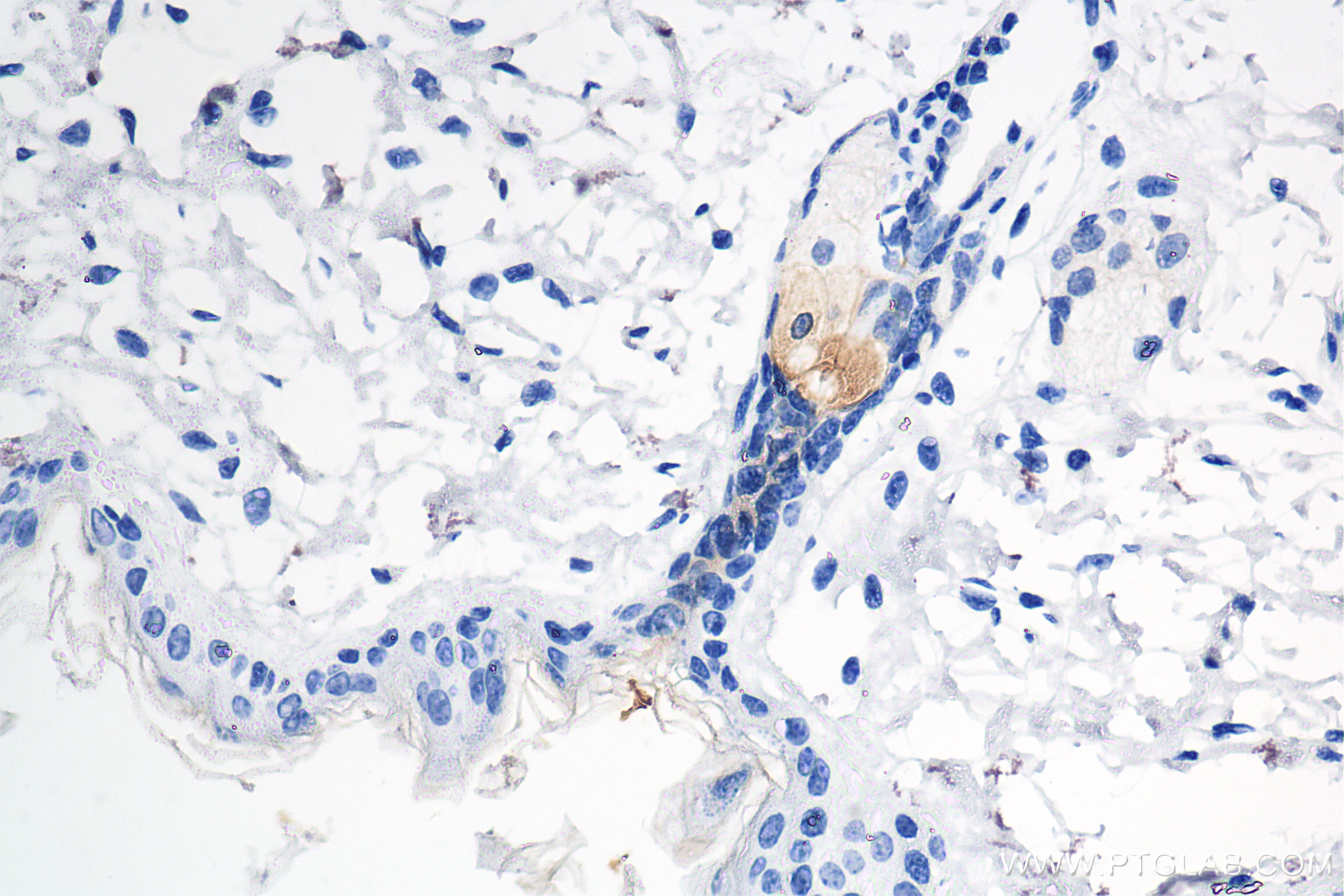 Immunohistochemistry (IHC) staining of mouse skin tissue using Cytokeratin 79 Recombinant antibody (86310-1-RR)