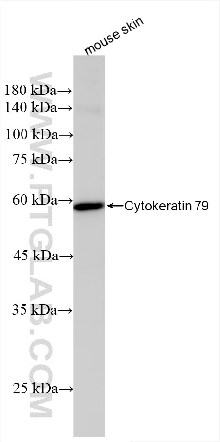 Western Blot (WB) analysis of mouse skin tissue using Cytokeratin 79 Recombinant antibody (86310-1-RR)