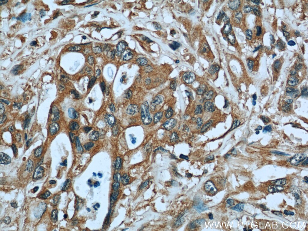 Cytokeratin 8 Monoclonal antibody