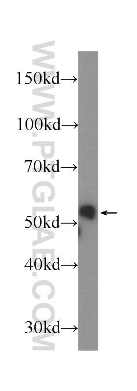 Western Blot (WB) analysis of A549 cells using Cytokeratin 8 Monoclonal antibody (60274-1-Ig)