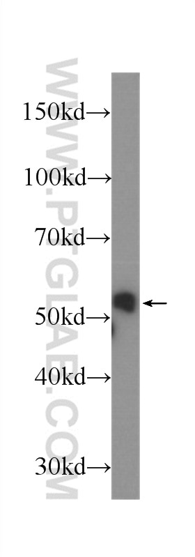 WB analysis of A549 using 60274-1-Ig