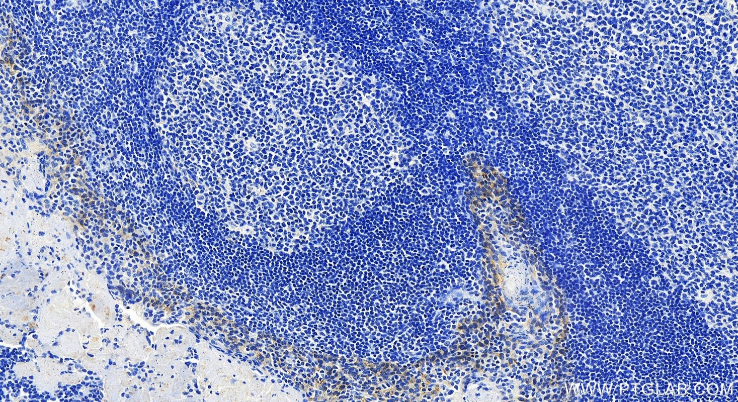 Cytokeratin 8