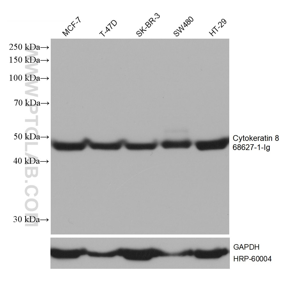 Western Blot (WB) analysis of various lysates using Cytokeratin 8 Monoclonal antibody (68627-1-Ig)