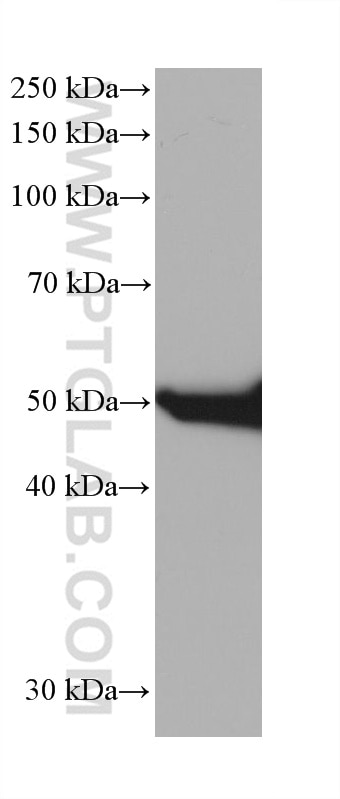 Western Blot (WB) analysis of A549 cells using Cytokeratin 8 Monoclonal antibody (68627-1-Ig)