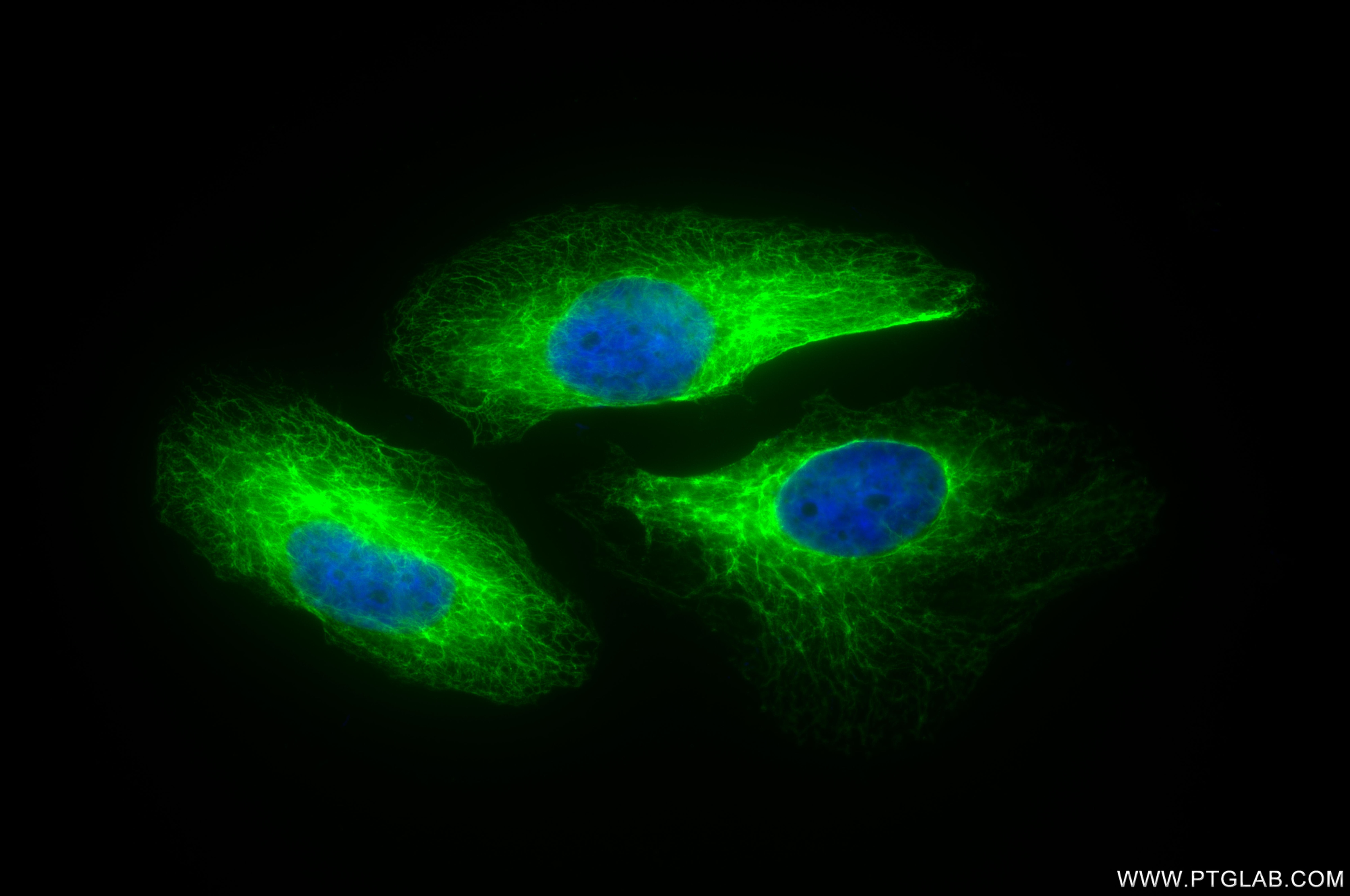 Immunofluorescent analysis of (-20°C Methanol) fixed HeLa cells using Cytokeratin 8 antibody (86457-4-RR, Clone: 251045E11 ) at dilution of 1:2000 and CoraLite®488-Conjugated Goat Anti-Rabbit IgG(H+L) (SA00013-2). This data was developed using the same antibody clone with 86457-4-PBS in a different storage buffer formulation. Immunofluorescence (IF) / fluorescent staining of HeLa cells using Cytokeratin 8 Recombinant monoclonal antibody (86457-4-RR)