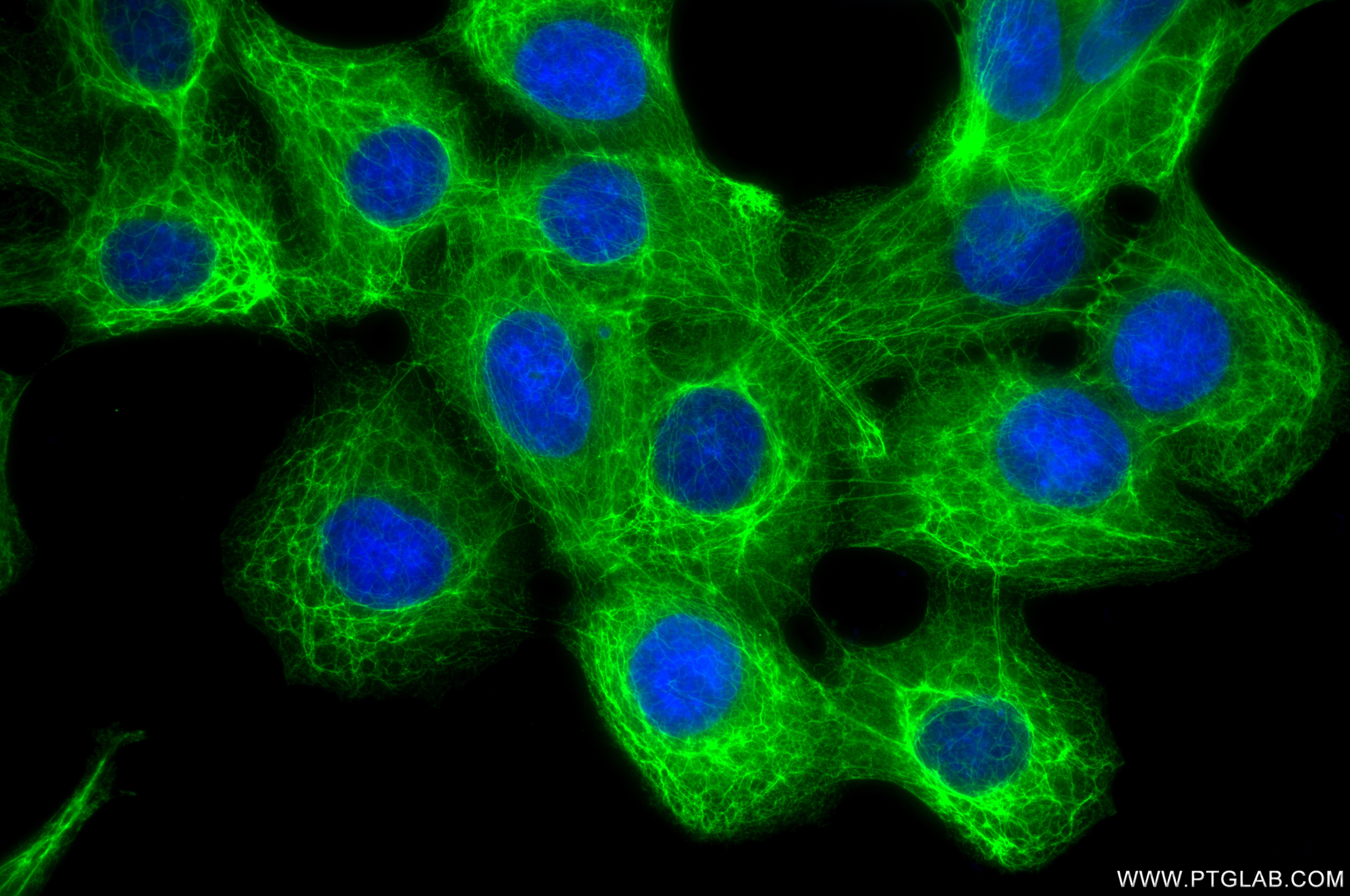 Immunofluorescent analysis of (-20°C Methanol) fixed A431 cells using Cytokeratin 8 antibody (86457-4-RR, Clone: 251045E11 ) at dilution of 1:2000 and CoraLite®488-Conjugated Goat Anti-Rabbit IgG(H+L) (SA00013-2). This data was developed using the same antibody clone with 86457-4-PBS in a different storage buffer formulation. Immunofluorescence (IF) / fluorescent staining of A431 cells using Cytokeratin 8 Recombinant monoclonal antibody (86457-4-RR)