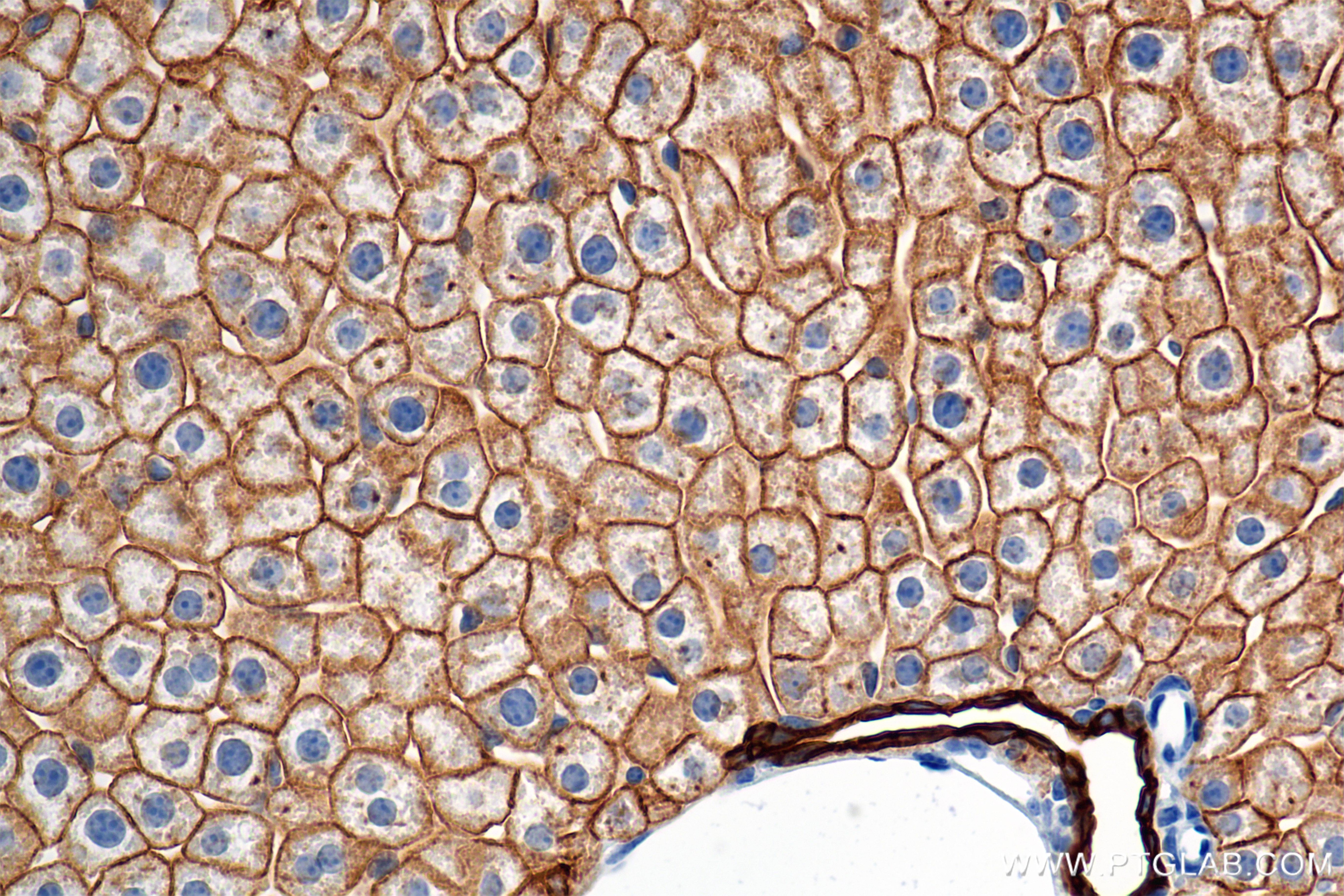 Immunohistochemical analysis of paraffin-embedded mouse liver tissue slide using 86457-4-RR (Cytokeratin 8 antibody) at dilution of 1:2000 (under 40x lens). Heat mediated antigen retrieval with Tris-EDTA buffer (pH 9.0). This data was developed using the same antibody clone with 86457-4-PBS in a different storage buffer formulation. Immunohistochemistry (IHC) staining of mouse liver tissue using Cytokeratin 8 Recombinant monoclonal antibody (86457-4-RR)