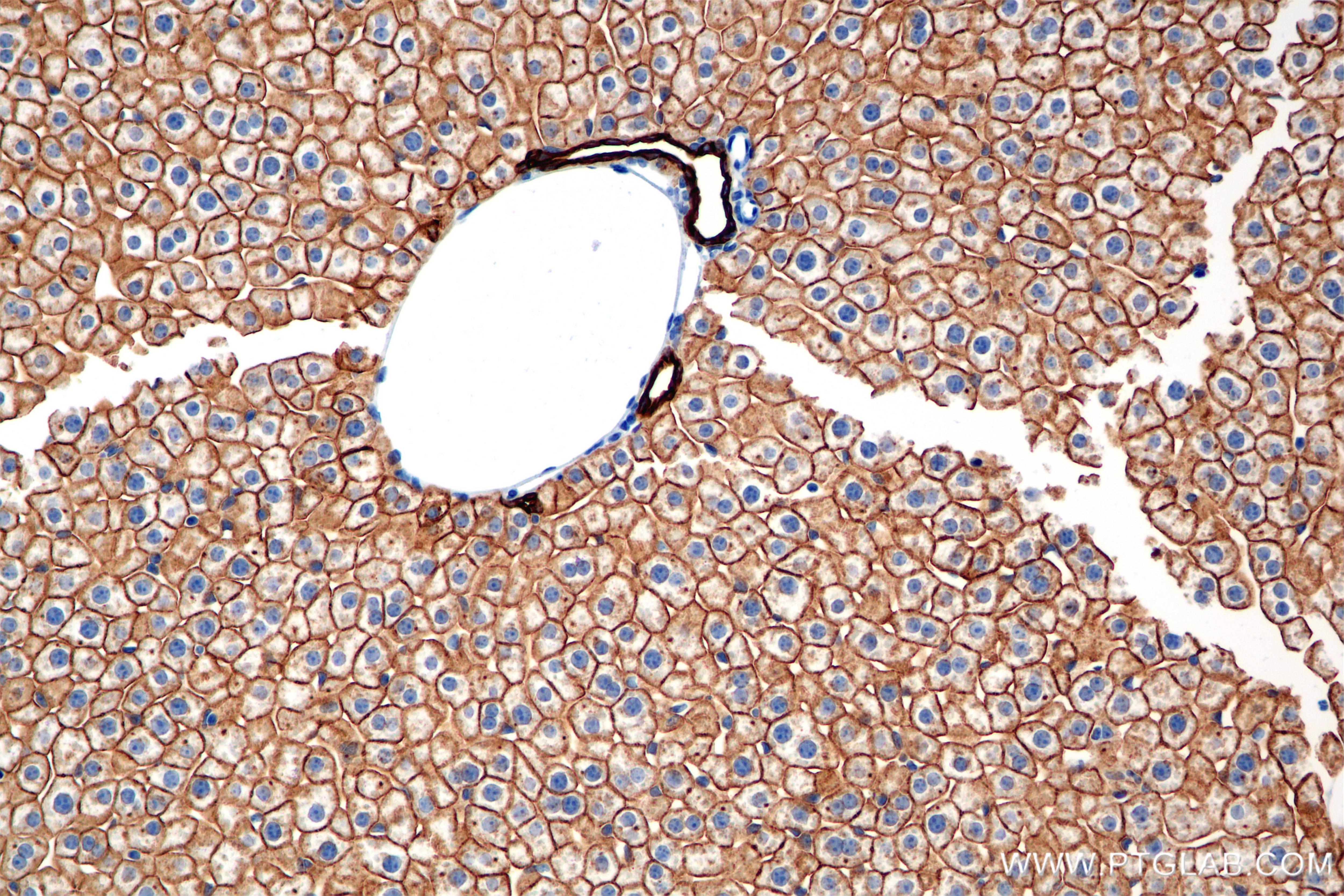 Immunohistochemical analysis of paraffin-embedded mouse liver tissue slide using 86457-4-RR (Cytokeratin 8 antibody) at dilution of 1:2000 (under 20x lens). Heat mediated antigen retrieval with Tris-EDTA buffer (pH 9.0). This data was developed using the same antibody clone with 86457-4-PBS in a different storage buffer formulation. Immunohistochemistry (IHC) staining of mouse liver tissue using Cytokeratin 8 Recombinant monoclonal antibody (86457-4-RR)