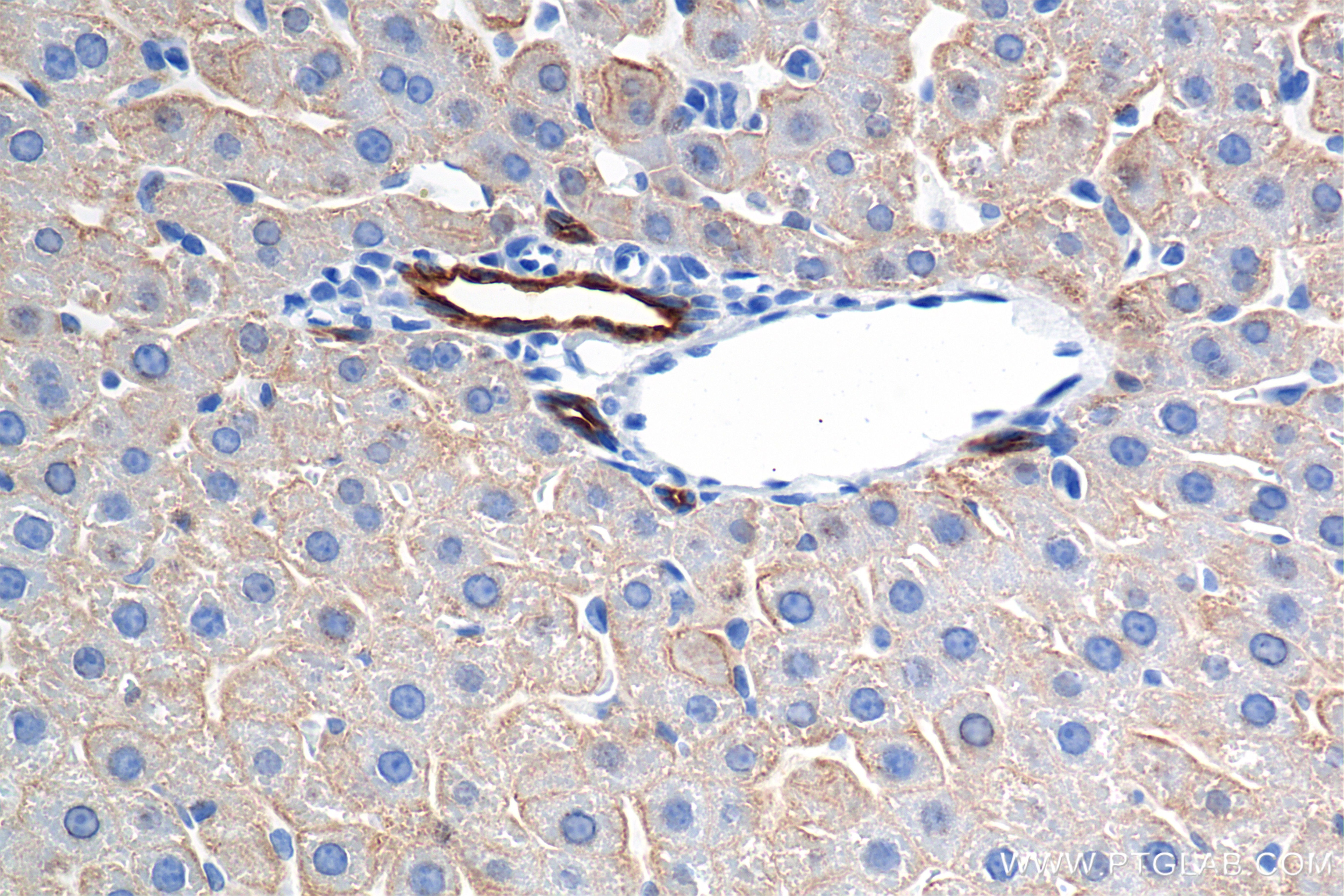 Immunohistochemical analysis of paraffin-embedded rat liver tissue slide using 86457-4-RR (Cytokeratin 8 antibody) at dilution of 1:2000 (under 40x lens). Heat mediated antigen retrieval with Tris-EDTA buffer (pH 9.0). This data was developed using the same antibody clone with 86457-4-PBS in a different storage buffer formulation. Immunohistochemistry (IHC) staining of rat liver tissue using Cytokeratin 8 Recombinant monoclonal antibody (86457-4-RR)