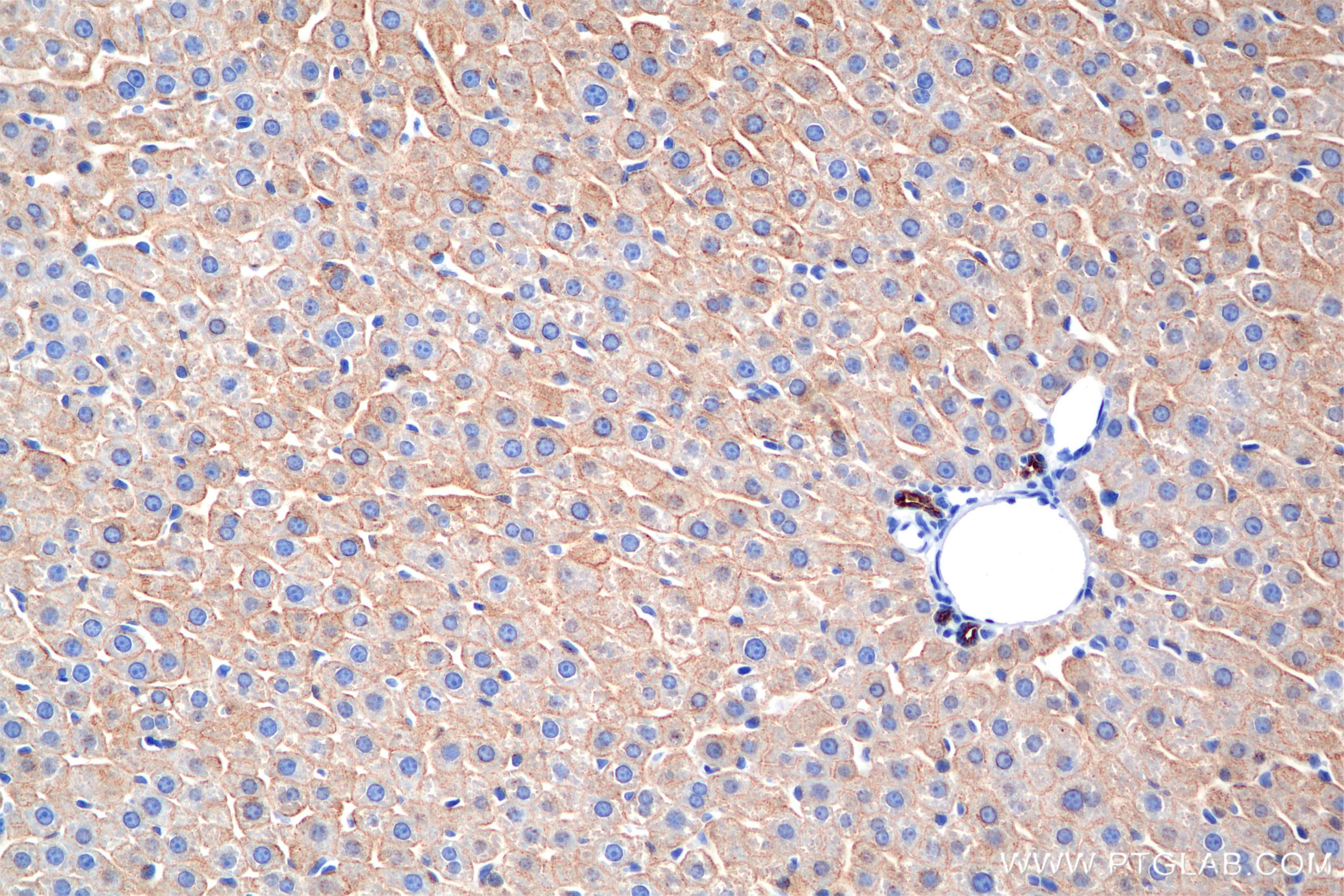 Immunohistochemical analysis of paraffin-embedded rat liver tissue slide using 86457-4-RR (Cytokeratin 8 antibody) at dilution of 1:2000 (under 20x lens). Heat mediated antigen retrieval with Tris-EDTA buffer (pH 9.0). This data was developed using the same antibody clone with 86457-4-PBS in a different storage buffer formulation. Immunohistochemistry (IHC) staining of rat liver tissue using Cytokeratin 8 Recombinant monoclonal antibody (86457-4-RR)